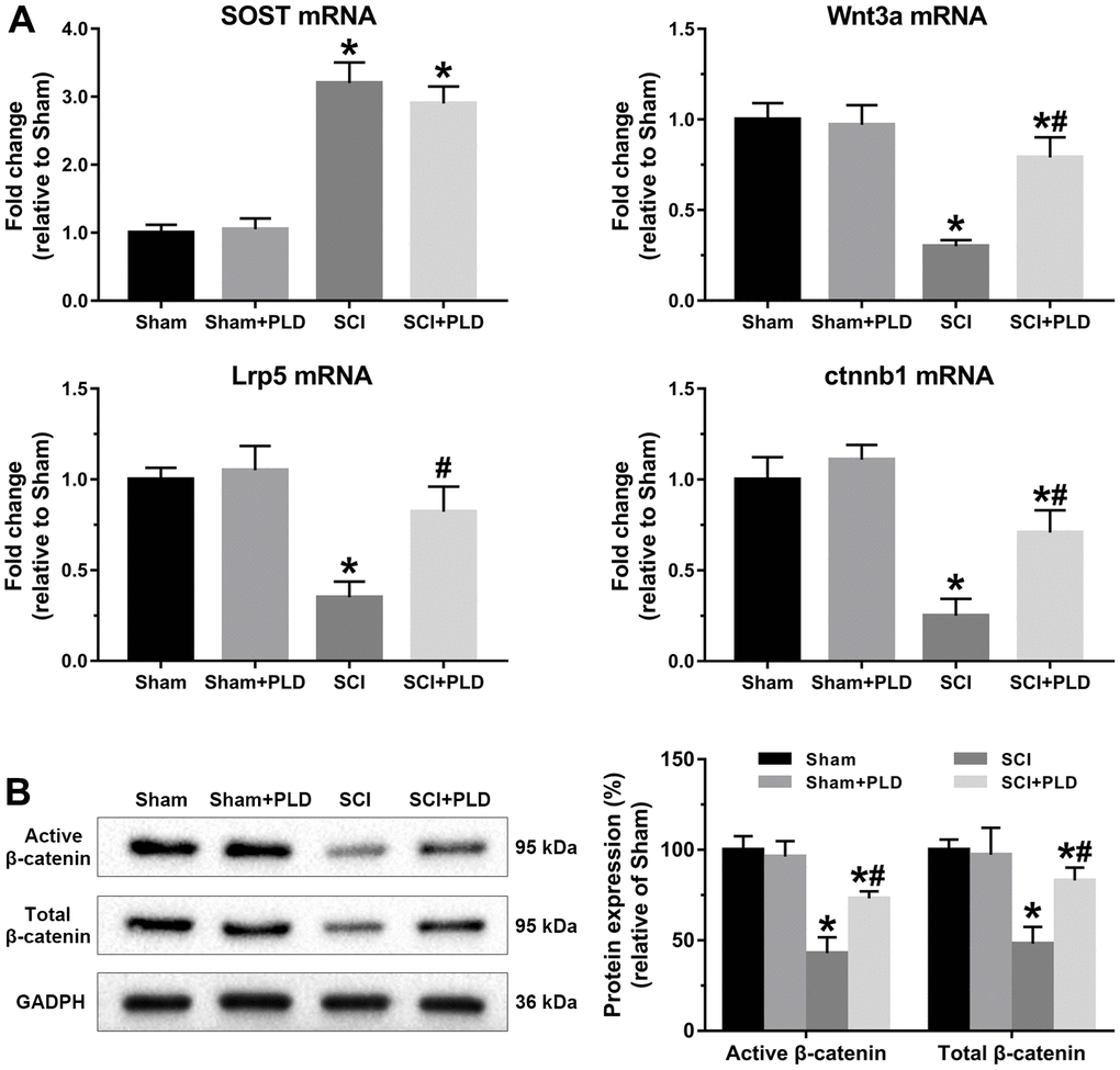 PLD activated Wnt/β-catenin signaling pathway in the femurs of chronic SCI mice. (A) SOST, Wnt3a, Lrp5 and ctnnb1 mRNA levels were determined by qRT-PCR method. (B) Immunoblot showing active β-catenin and total β-catenin levels. The protein levels of β-catenin were adjusted as relative values to GAPDH. Data are expressed as mean ± S.D.; n=5 to 7 per group; *P P 