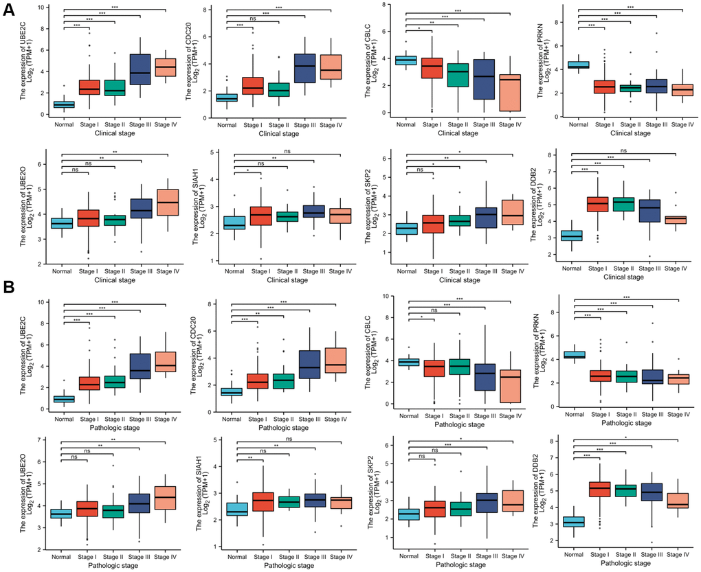 Correlation between risk genes expression and clinicopathological parameter of PRCC. (A) Boxplot showing that superior expression of UBE2C, DCB2, UBE2O, SIAH1, SKP2, and CDC20 were significantly related to advanced pathological grades, whereas low expression of CBLC and PRKN was significantly correlated with severe pathological features. (B) Boxplot showing that the expression of UBE2C, DCB2, SKP2, UBE2O, SIAH1, and CDC20 mRNA in PRCC samples are significantly correlated with severe pathologic staging and the expression of CBLC and PRKN at mRNA level were lower in patients with stage 4. *P **P ***P 