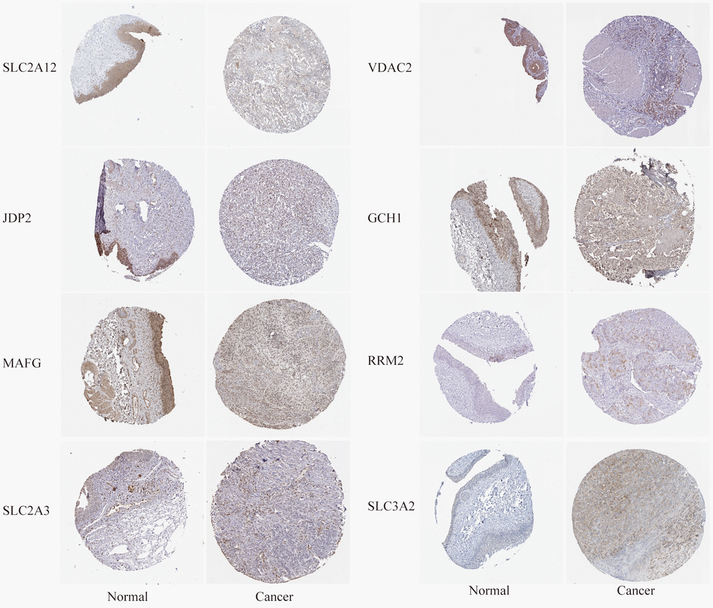 The differential expression of some FRGs at the protein level was verified using the human protein atlas (HPA, https://www.proteinatlas.org/) website.