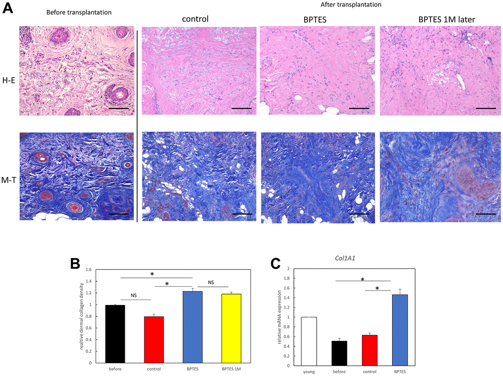 Senescent cell elimination drug BPTES improves the skin senescence phenotype of hairless mouse skin. (A) Evaluation of skin collagen deposition using representative images of MT and H&E staining. (B) Quantification of collagen density in skin sections from the indicated mice. Data represent three or more random sites in each section (n = 3–5). (C) Relative mRNA levels of Col1a1 in the skin from aged mice. *p U test; bar = 100 μm.