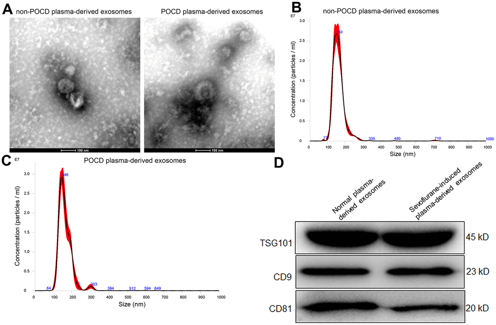 Characterization of exosomes isolated from the plasma of sevoflurane-induced post operative cognitive dysfunction (POCD) patients or non-POCD patients. (A) The morphology of exosomes was visualized using a transmission electron microscopy. A NanoSight NS300 particle size analyser was used to analyze the particle size of the exosomes isolated from the plasma of sevoflurane-induced non-POCD patients (B) and POCD patients (C). (D) The expression of exosomes-specific markers TSG101, CD9 and CD81 examined by western blot.