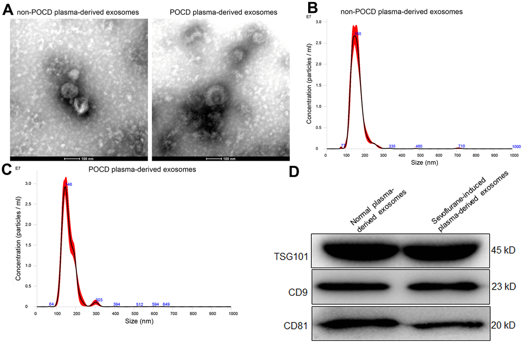 Sevoflurane-induced POCD-associated exosomes delivered miR-584-5p