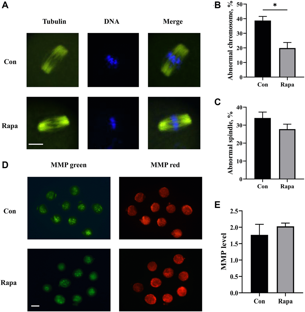 Effects of rapamycin on the quality of IVM oocytes. (A) The immunofluorescence images of spindle and chromosome of IVM oocytes from both groups. Scale bar, 25 μm. (B) The percentages of oocytes with chromosome aberration (n = 86). (C) The percentages of oocytes with abnormal spindle morphology (n = 86). (D) The immunofluorescence images showing JC-1 staining intensity in oocytes matured in different media. Scale bar, 75 μm. (E) The relative levels of MMP (red/green fluorescence intensity) in oocytes from both groups (n = 49). All data were expressed as mean ± SEM from three independent experiments. *P 