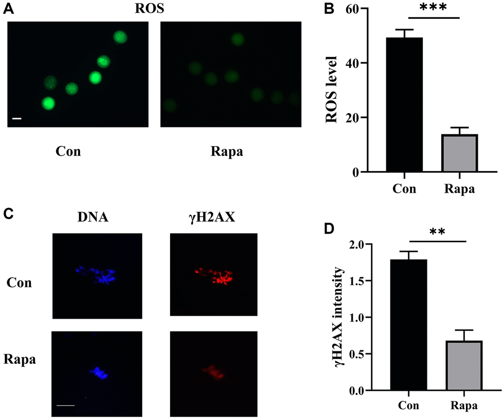Effects of rapamycin on the levels of ROS and γ-H2AX of IVM oocytes. (A) The fluorescence images of ROS. Scale bar, 75 μm. (B) The levels of ROS in oocytes from both groups (fluorescence intensity value) (n = 43). (C) The fluorescence images of DNA and γ-H2AX in oocytes. Scale bar, 25 μm. (D) The intensity of γ-H2AX normalized to the mean DNA intensity in both groups (n = 29). **P ***P 