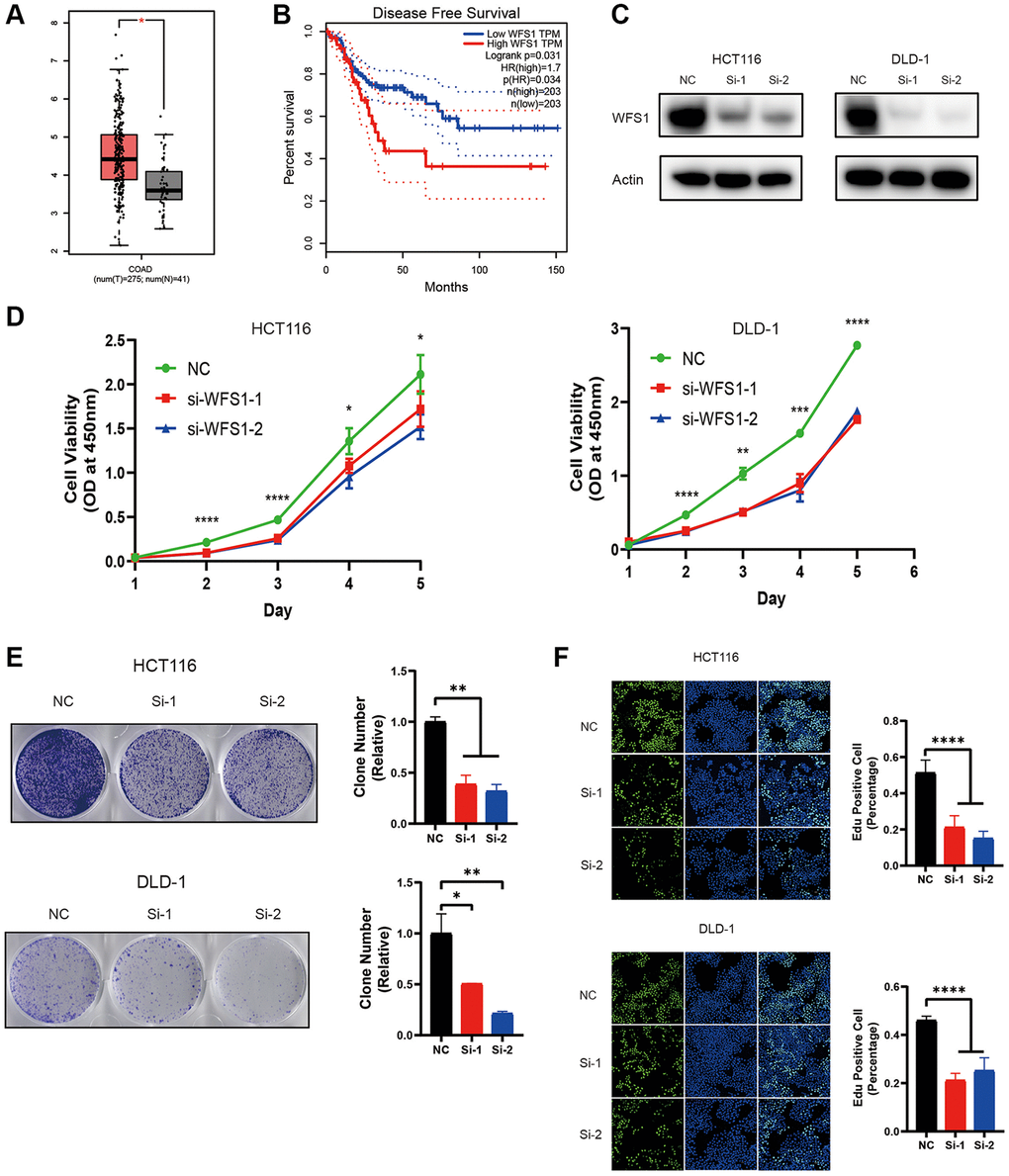 Knockdown of WFS1 inhibits COAD cell proliferation. (A) Box plots showed that WFS1 expression was significantly higher in COAD than in normal samples. (B) Survival curves showed that patients in the low WFS1 expression group had a better prognosis than those in the high WFS1 expression group. (C) Western blot analysis of WFS1 expression in HCT116 and DLD-1 cell lines. actin is internal control. (D) Cell viability of HCT116 or DLD-1 cells transfected with control or WFS1siRNAs was measured by CCK8 assay. (E) Clone formation assay of HCT116 or DLD-1 cells transfected with control or WFS1siRNAs. (F) EdU staining for cell proliferation transfected with control or WFS1siRNAs.