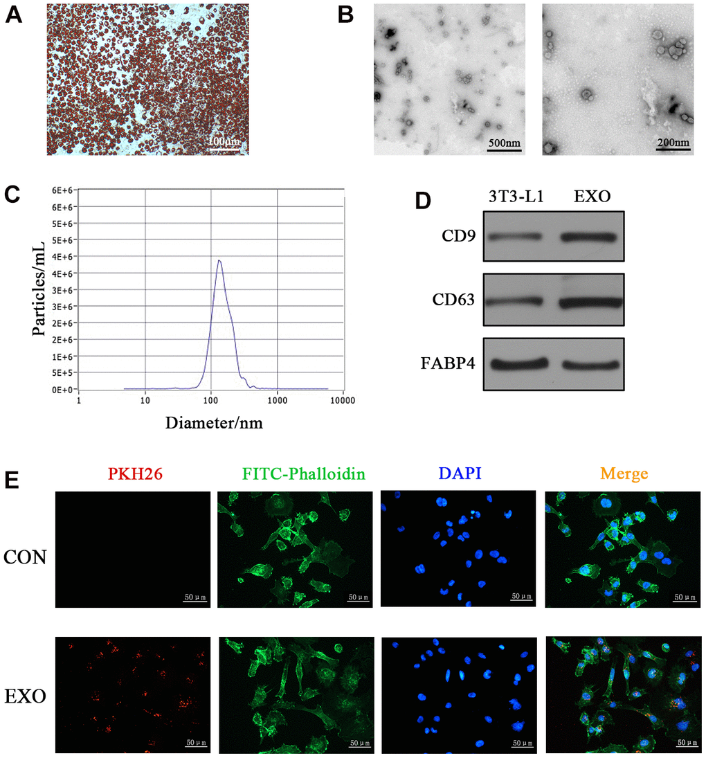 Characterization of adipocyte-derived exosomes. (A) Oil red O staining of differentiated 3T3-L1 cells. (B) TEM analyses of exosomes secreted by adipocytes. (C) NTA of exosomes. (D) Western blotting analyses of exosomal markers (CD9, CD63 and FABP4) in 3T3-L1 cells and adipocyte-derived exosomes. (E) Fluorescence images of HOMECs incubated with PKH26-labelled exosomes (red). The cytoskeleton was stained with phalloidin-FITC (green), and nuclei were stained with DAPI (blue).