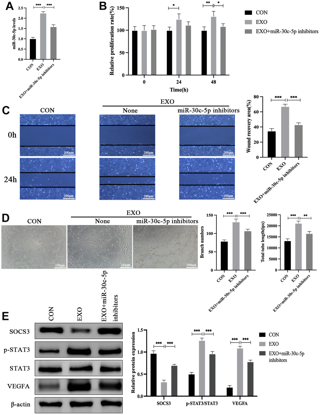 miR-30c-5p mediates the effects of adipocyte-derived exosomes on the biological function of HOMECs and the SOCS3/STAT3/VEGFA pathway. (A) qRT-PCR detection of the effect of exosomes combined with or without miR-30c-5p inhibitors on miR-30c-5p levels in HOMECs. (B) Detection of the effect of exosomal miR-30c-5p on the cell proliferation by the CCK-8 assay. (C) Detection of the effect of exosomal miR-30c-5p on the cell migration by the wound healing assay. (D) Detection of the effect of exosomal miR-30c-5p on the cell tube formation capacity by the tube formation assay. (E) Western blotting analyses of the effect of exosomal miR-30c-5p on SOCS3/STAT3/VEGFA pathway expression in HOMECs. Data are presented as mean ± SD for three independent experiments. *P