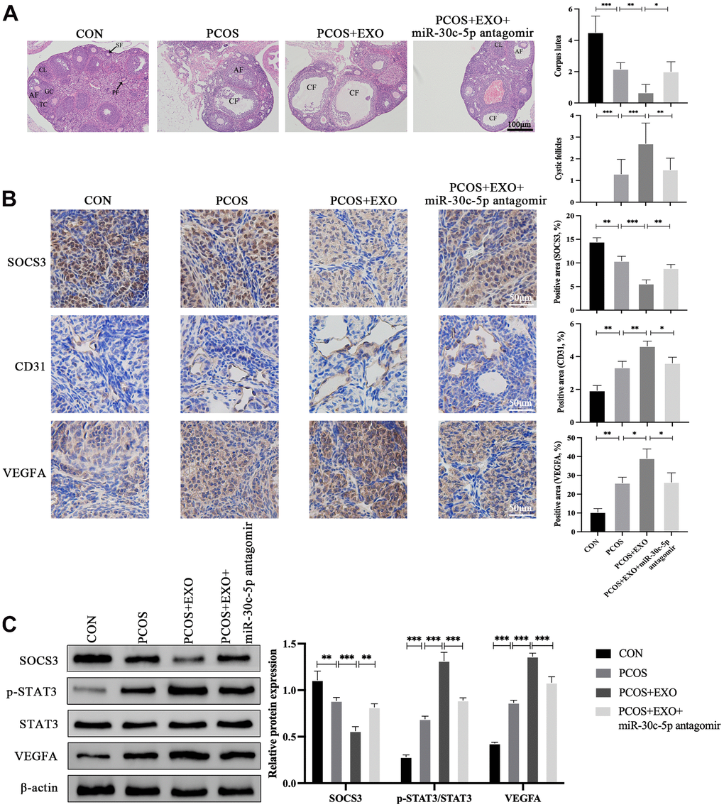Adipocyte-derived exosomal miR-30c-5p mediates ovarian angiogenesis through the SOCS3/STAT3/VEGFA pathway. (A) Visualization of the ovarian morphology in the indicated groups by HE staining. (B) Detection of SOCS3, CD31 and VEGFA expression in the ovaries in the indicated groups by IHC staining. (C) Western blotting analyses of the SOCS3/STAT3/VEGFA pathway expression in the indicated groups. Primary follicles (PFs), granulosa cells (GCs), theca cells (TCs), secondary follicles (SFs), antral follicles (AFs), corpus luteum (CL), and cystic follicles (CFs). Data are presented as mean ± SD for three independent experiments. *P
