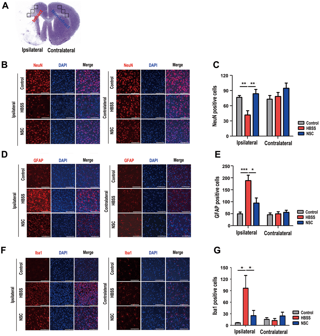 Effects of ahNSCs on density of neurons, astrogliosis, and microglial activation. (A) Ipsilateral infarct and contralateral non-infarct areas examined for each animal are illustrated. (B) The density of neurons was examined by immunofluorescence against NeuN at 28 d after ahNSCs transplantation. Representative images illustrate each group (n = 5 for the control group, n = 6 for the HBSS group, n = 5 for the NSC group). Scale bar = 100 μm. (C) The numbers of NeuN-positive cells were calculated and then compared. Mean ± SEM. ** P D) Astrogliosis was examined by immunofluorescence against GFAP at 28 d after ahNSCs transplantation. Representative images illustrate each group (n = 5 for the control group, n = 6 for the HBSS group, n = 5 for the NSC group). Scale bar = 100 μm. (E) The numbers of GFAP-positive cells were calculated and then compared. Mean ± SEM. * P F) Microglial activation was examined by immunofluorescence against Iba1 at 28 d after ahNSCs transplantation. Representative images illustrate each group (n = 5 for the control group, n = 6 for the HBSS group, n = 5 for the NSC group). Scale bar = 100 μm. (G) The numbers of Iba1-positive cells were calculated and then compared. Mean ± SEM. * P 