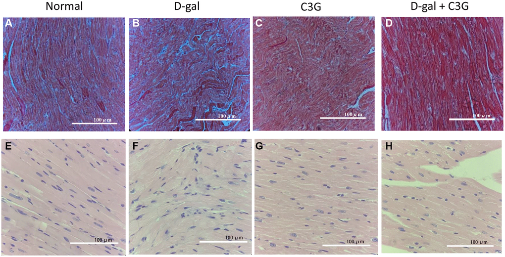 D-gal induced aging in mouse myocardial tissues, and C3G alleviated the tissue injury. Histological sections of cardiac tissues were stained with Masson's trichrome (A–D) or hematoxylin-eosin (E–H). Magnification, 10×.