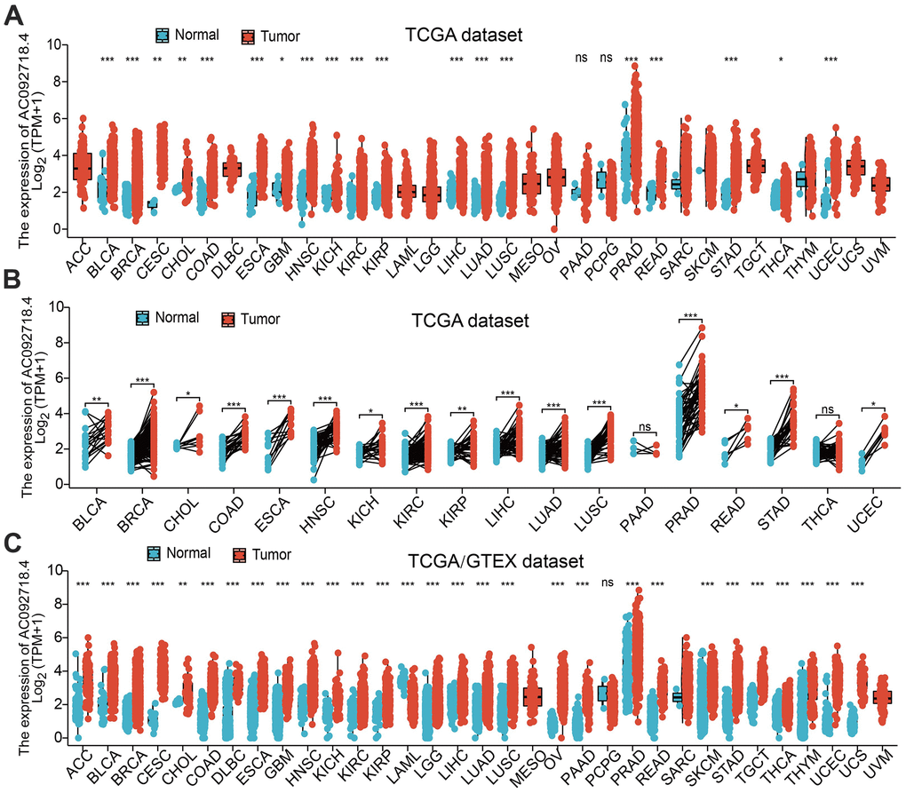 AC092718.4 expressed differentially between tumor and normal tissues. (A) The expression of AC092718.4 in pan-cancer analysis by the TCGA database (B) The expression of AC092718.4 in paired cancer tissues and adjacent normal tissues from TCGA datasets (C) AC092718.4 differential expression across different cancer types in the TCGA and GTEx databases. *P 