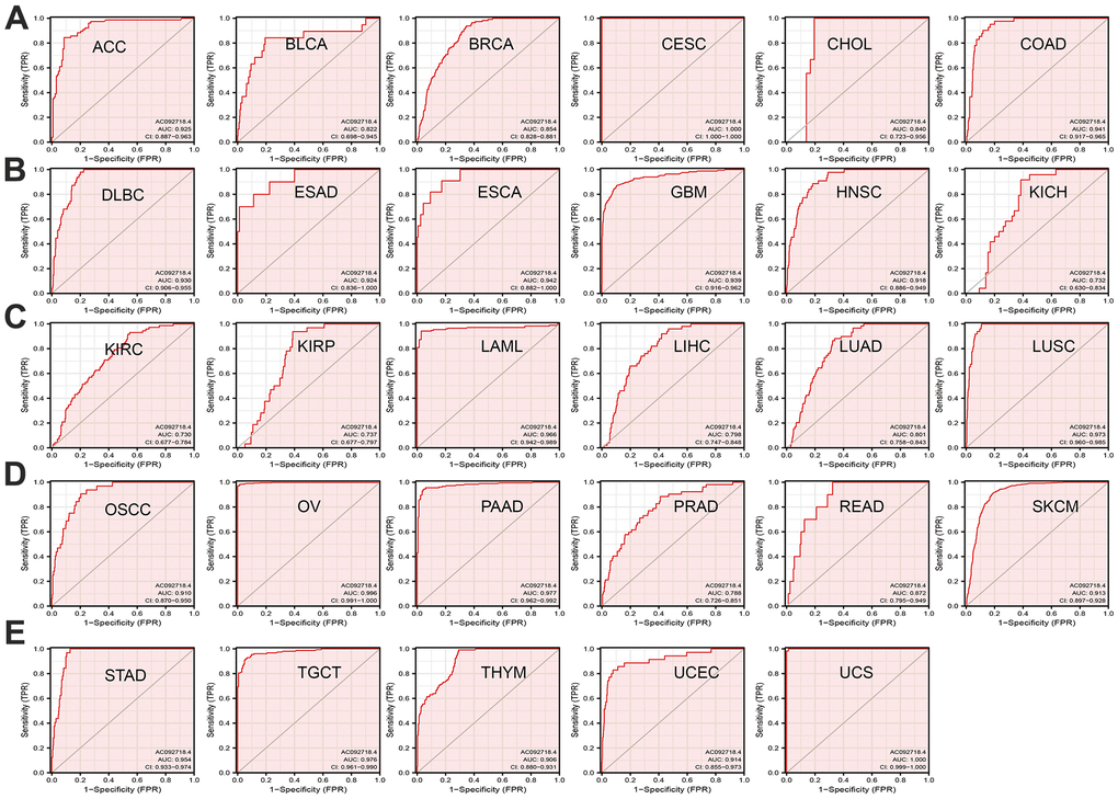 AC092718.4 may act as a potential biomarker in human cancer. (A–E) Predictive power for prognosis with AC092718.4 expression by ROC curve analysis in pan-cancer.