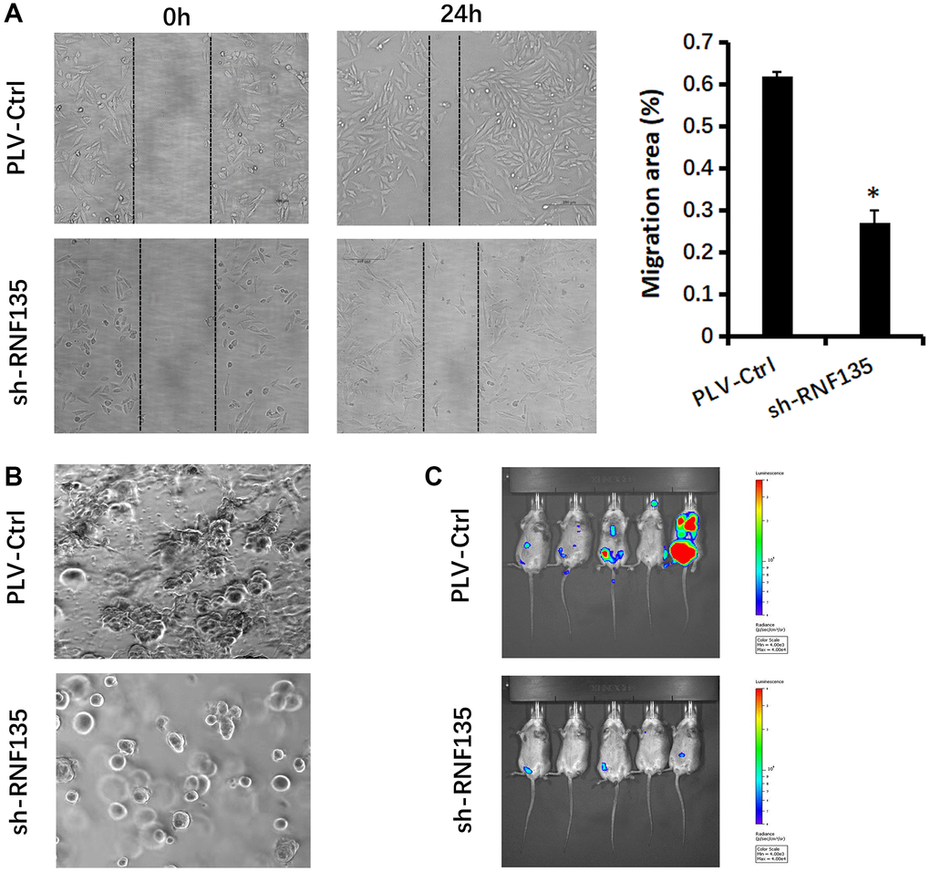 Relationship between RNF135 and migration ability of MDA-MB-231 cells. (A) Migration of MDA-MB-231 cells was detected via wound healing assay. (B) Changs in cellular morphology of MDA-MB-231 cells were investigated via 3D culture. (C) Bioluminescent imaging of mice harboring metastases after tail vein injection of MDA-MB-231-luc cells at week 5. Data are presented as the mean ± SD for three independent experiments (*P 