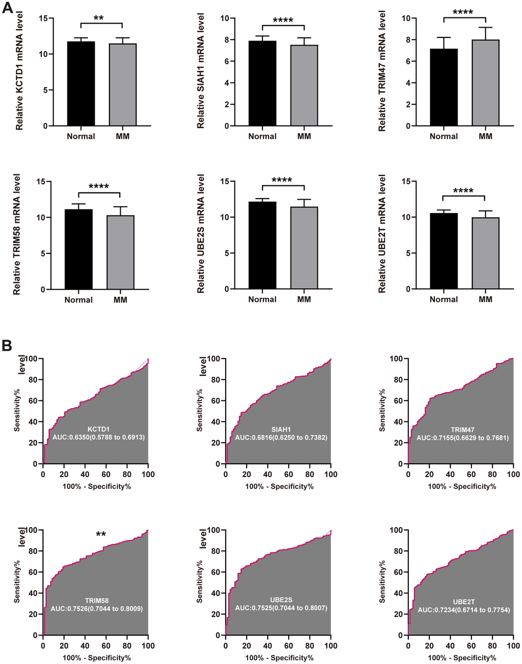 Diagnostic value of the identified UPS genes for MM. (A) The expression level of KCTD12, SIAH1, TRIM58, TRIM47, UBE2S, and UBE2T in tumor normal tissue. (B) ROC analysis showed the diagnostic ability of KCTD12, SIAH1, TRIM58, TRIM47, UBE2S, and UBE2T to distinguish MM from the normal samples (**P