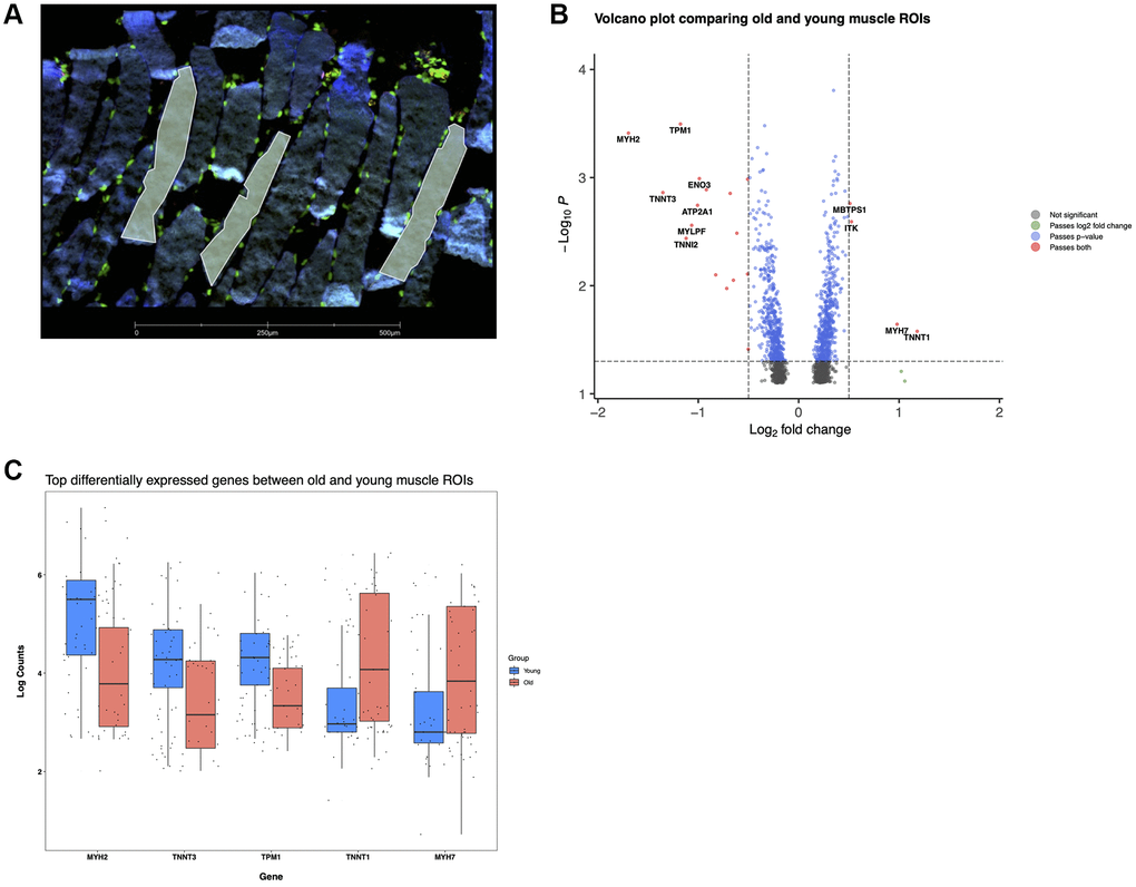 Reorganization of muscle fibers with age revealed by spatial transcriptomics. (A) Young muscle fibers, several ROls are shown in yellow delineating individual sections of distinct fibers. Desmin (blue), Syto83 (green), aSMA (yellow), CD68 (red). (B) Differentially expressed genes in old versus young spatial profiled muscle. (C) log (counts) of top differentially expressed genes.