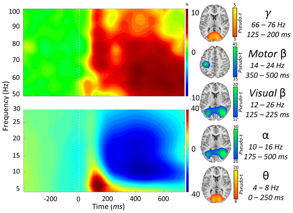 Neural responses to the visuospatial discrimination task. (Left): Grand-averaged time frequency spectrograms of MEG sensors exhibiting one or more significant responses. Shown from top to bottom: gamma, motor beta, visual beta, alpha, and theta activity. In each spectrogram, frequency (Hz) is shown on the y-axis, and time (ms) is shown on the x-axis. Signal power data are expressed as a percent difference from the baseline period, with color legends shown with each spectrogram. (Right): Grand-averaged beamformer images (pseudo-t) across all participants for each time-frequency component.
