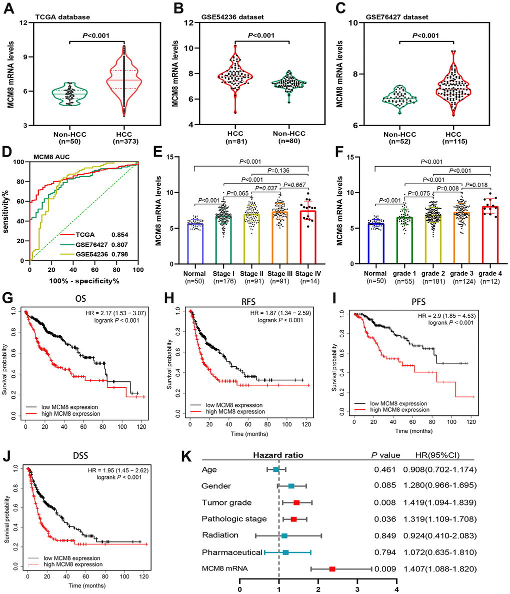 MCM8 mRNA levels in HCC and adjacent normal liver tissues and its prognostic value. (A–C) MCM8 mRNA was up-regulated in HCC tissues in TCGA (A), GSE54236 (B) and GSE76426 (C) datasets. (D) ROC curve shows the diagnostic significance of MCM8 mRNA for HCC in TCGA and GEO databases. (E, F) The MCM8 mRNA levels gradually increased with the progression of tumor stage (E) and grade (F). (G–J) High MCM8 expression was correlated with poor OS (G), RFS (H), PFS (I) and DSS (J) in HCC. (K) Higher MCM8 mRNA level was one of the independent risk factors for OS in TCGA database.