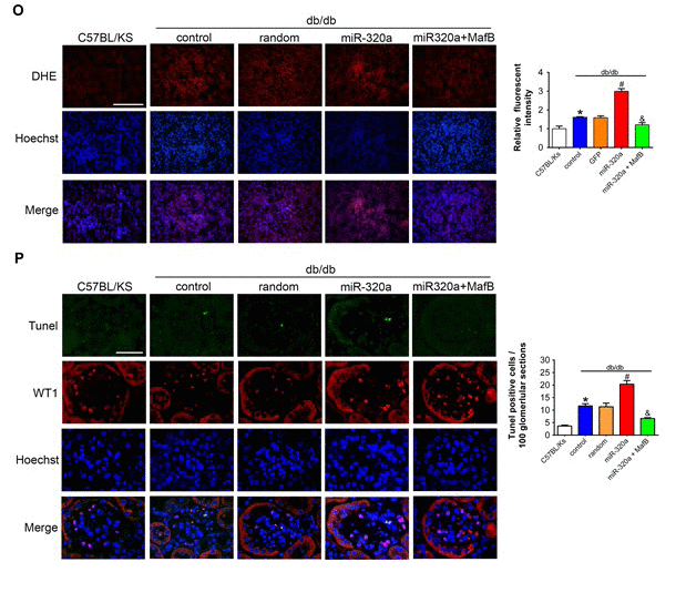 MafB restoration attenuated miR-320a induced kidney injury in diabetes.... (O) Representative images of ROS detected by DHE probe in frozen kidney sections. Scale bar, 200 μm. (P) Typical images of apoptotic glomerular cells in diabetic glomeruli. Green, TUNEL; Red, WT1; Blue, Hoechst. Scale bar, 50 μm. Data are expressed as mean ± SEM, n=8, *P