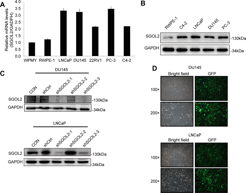 The construction of the shSGOL2 model was evaluated in prostate cancer cell lines. (A) Expression level of SGOL2 was detected in normal prostate cell lines and prostate cancer cell lines by qRT-PCR. (B) Efficiency of SGOL2 knockdown was accessed by WB in different cell lines. (C) Efficiency of SGOL2 knockdown was examined by WB in DU145 and LNCaP. (D) The fluorescence intensity and morphology of infected cells were observed in DU145 and LNCaP.