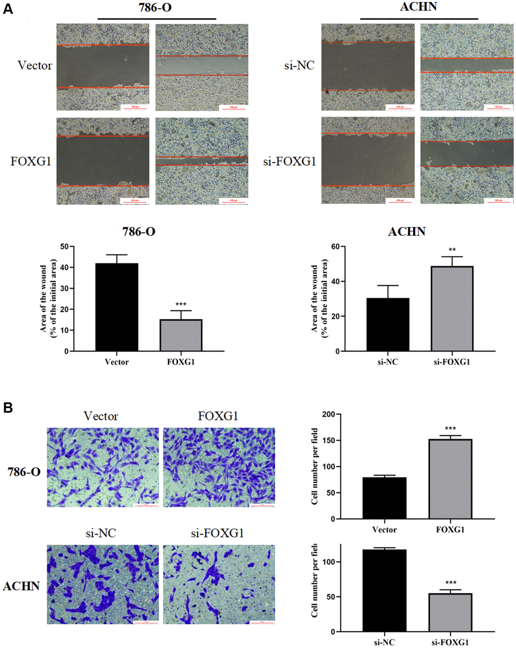 FOXG1 promotes migration and invasion of RCC cell lines. (A) Wound healing assay results of 786-O and ACHN cells after overexpression or knockdown of FOXG1. (B) Transwell assay result of 786-O and ACHN cells following FOXG1 overexpression or silencing. The data are presented as the mean ± standard deviation (SD) of experiments performed in triplicate. *p **p ***p 