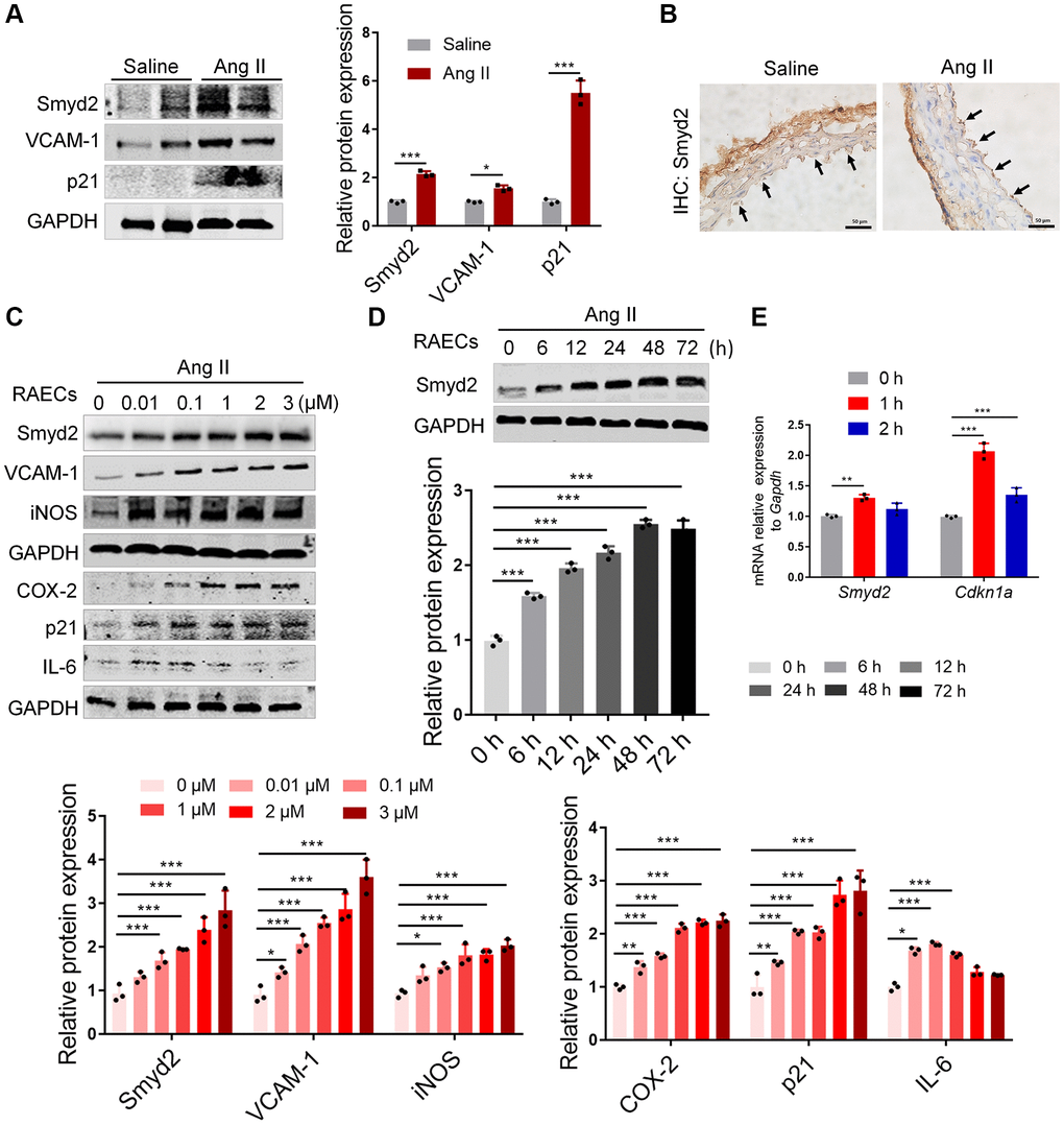 Smyd2 is upregulated in vascular aging both in vivo and in vitro. (A, B) The in vivo aging model was established by Ang II infusion in mice for 28 days and harvested the aortas. The protein expressions of Smyd2, VCAM-1, and p21 were detected by immunoblots (A). The immunohistochemistry assay was performed with Smyd2 antibody. Scale bars, 50 μm (B). (C–E) Ang II (100 nM, 48 h)-induced RAECs was used as the in vitro aging model. Smyd2 and the senescence-related phenotype markers were increased in a dose-dependent manner in Ang II-induced RAECs (C). The protein expression of Smyd2 was increased in a time-dependent manner in Ang II-induced RAECs (D). RT-qPCR analysis of Smyd2 and Cdkn1a genes in Ang II-induced RAECs (E). Data are presented as the mean ± SEMs, *p **p ***p n = 3).