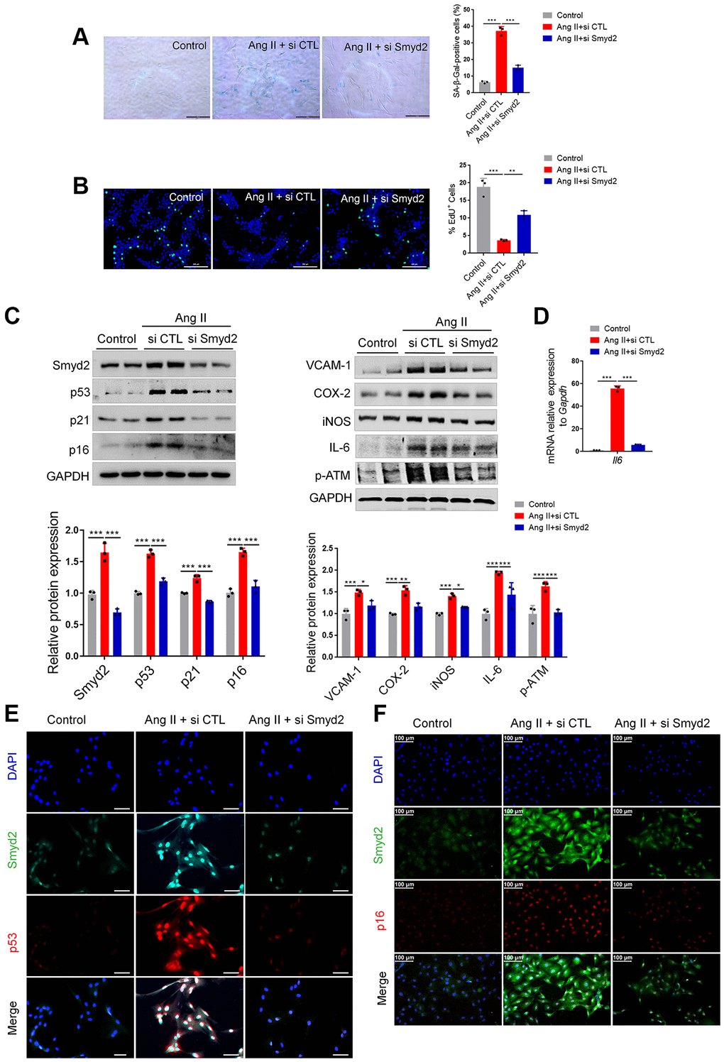 Knockdown of Smyd2 attenuates Ang II-induced RAECs senescence. Smyd2 was knocked down using si Smyd2 in Ang II-induced RAECs, si CTL was used as the negative control. (A, B) The SA-β-gal staining and EdU incorporation assay. Representative staining images are shown in the figure left, and the statistical analysis of positive cells is shown on the right. Scale bars, 200 μm. (C) Western blot analysis of Smyd2 and the senescence markers (p53, p21 and p16), the proinflammatory mediators (iNOS, VCAM-1, COX-2 and IL-6) and the DNA damage marker (p-ATM) protein. Representative western blot images are shown in the figure above, and the statistical analysis of relative protein expression is shown below. GAPDH was used as the loading control. (D) The mRNA expression of Il6 gene by RT-qPCR analysis. (E, F) Immunofluorescence double staining of Smyd2 and the senescence markers (p53 and p16). Scale bars, 100 μm. Data are presented as the mean ± SEMs, *p **p ***p n = 3).