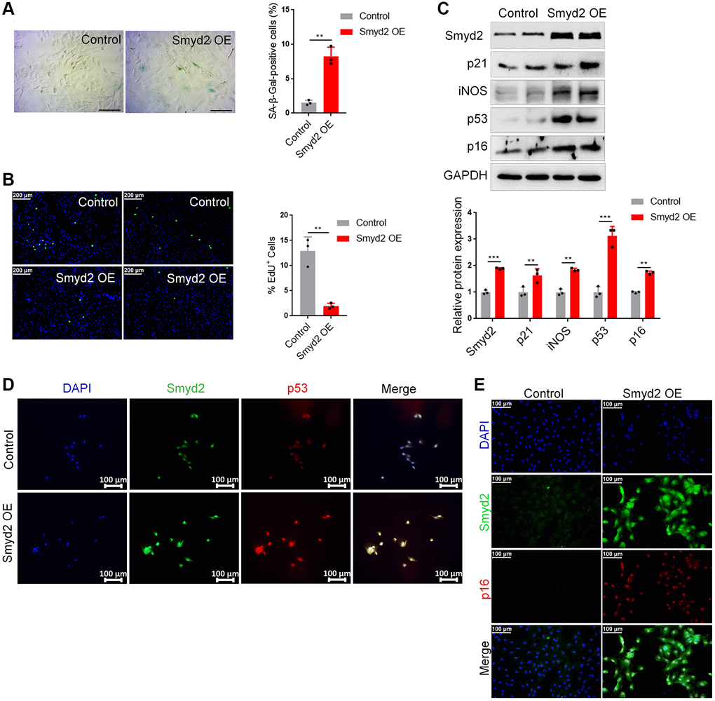 Overexpression of Smyd2 alone promotes the vascular endothelial senescence. Smyd2 was overexpressed (Smyd2 OE) in RAECs by transfecting with lentiviruses. (A, B) SA-β-gal staining (A) and EdU incorporation (B) assays in RAECs. Representative staining images are shown in the figure left, and the statistical analysis of positive cells is shown in the figure right. (C) Immunoblots of the senescence-associated markers (p53, p21, p16 and iNOS) proteins were detected by western blot assay, and the statistical analysis of relative protein expression is shown below. GAPDH was used as the loading control. (D, E) Immunofluorescence double staining of Smyd2 and p53 or p16 protein in RAECs transduced with lentiviruses expressing Smyd2. Scale bars, 100 μm. Data are presented as the mean ± SEMs, *p **p ***p n = 3).