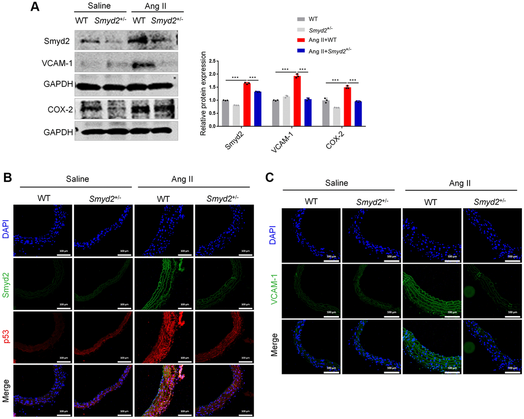 Smyd2 heterozygous knockout mice ameliorates senescence-associated phenotypes upon Ang II infusion. Smyd2+/− mice and their wild-type littermates (WT) were infused with Ang II for 4 weeks. (A) Immunoblots of the proinflammatory mediators (COX-2 and VCAM-1). (B, C) The immunofluorescence analysis of Smyd2 with p53 or VCAM-1 in the cross-sectional area of blood vessels. Scale bars, 100 μm. Data are presented as the mean ± SEMs, ***p n = 3).