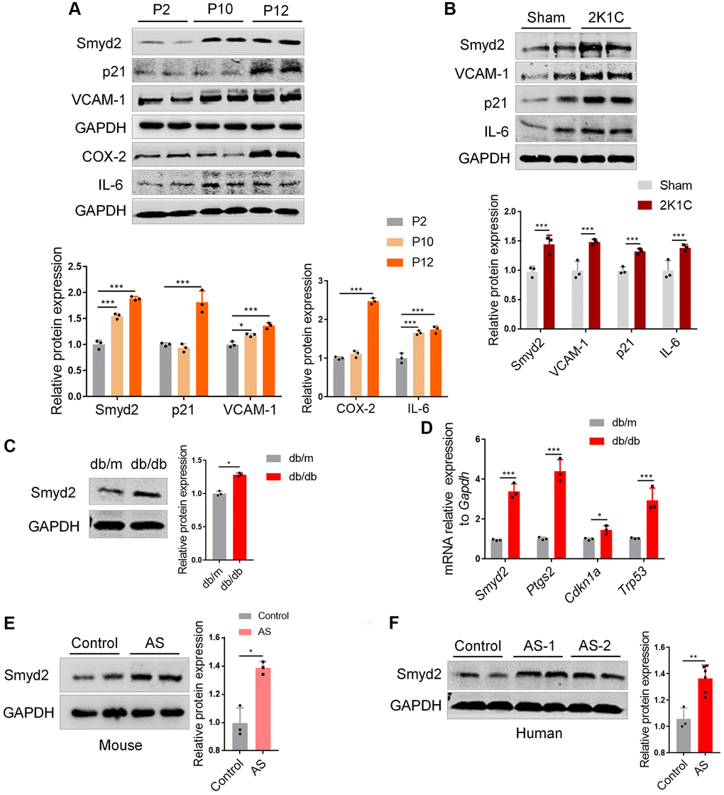 Smyd2 is associated with other vascular aging-related diseases. (A) The protein expressions of Smyd2, the senescence marker (p21) and the proinflammatory mediators (VCAM-1, COX-2 and IL-6) were examined in a later passage of RAECs by Western blot. GAPDH was used as the loading control. (B) Western blot analysis of Smyd2 and the senescence markers (p21, VCAM-1 and IL-6) in arteries of two-kidney one-clip renovascular hypertensive (2K1C) mice. The statistical analysis of relative protein expression is shown in the figure below. (C) Western blot analysis of Smyd2 in arteries of db/db mice and its control db/m mice. (D) The mRNA levels of Smyd2 and the senescence marker genes (Ptgs2, Cdkn1a and Trp53) in arteries of db/db mice and its control db/m mice. (E) The expression of Smyd2 in mice atherosclerotic artery samples was evaluated by western blot. (F) The protein level of Smyd2 in thoracic aorta in healthy (control) and atherosclerotic (AS) patients evaluated by western blot. Data are presented as the mean ± SEMs, n = 3 or 6. *p **p ***p 
