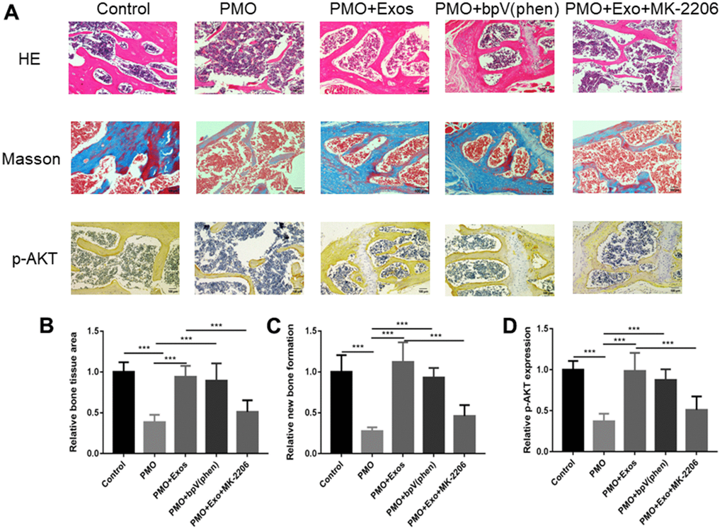 (A) HE staining, Masson staining and IHC (p-AKT) staining were performed to investigate osteogenesis between different groups. (B) The bone volume was calculated by HE staining using ImageJ. (C) The new bone formation rate was calculated by HE staining using ImageJ. (D) The expression of p-AKT was calculated by HE staining using ImageJ.