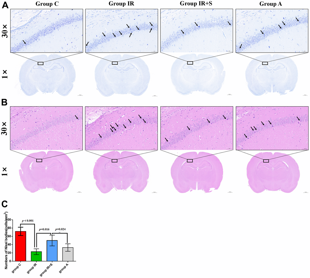 Sevoflurane postconditioning reduced neuropathic damage after cerebral I/R injury. (A) Representative photomicrographs of Nissl staining in the hippocampal CA1 region (scale bar = 50 μm and 1000 μm respectively). The arrow points to shrunk and degenerated cells in CA1 region. (B) Representative images of histopathological changes in the hippocampal CA1 of rats (scale bar = 50 μm and 1000 μm respectively). The arrow points to shrunk and degenerated cells in CA1 region. (C) Quantification of numbers of Nissl bodies in the hippocampal CA1 region. Data are expressed as mean ± SD (n = 5 per group).