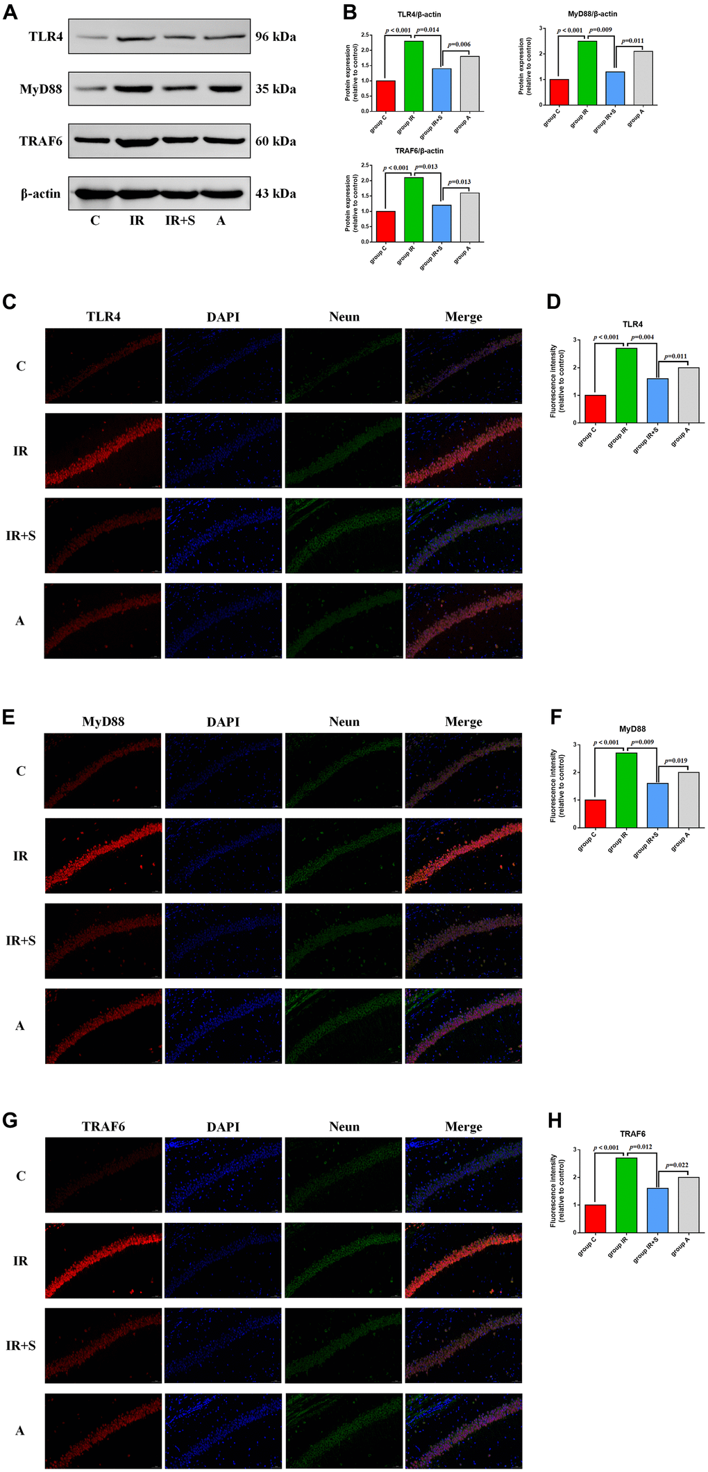 Sevoflurane postconditioning inhibits the TLR4/MyD88/TRAF6 signaling pathway to exert a neuroprotective effect in cerebral I/R rats. (A) Representative western blot of TLR4, MyD88, and TRAF6. (B) Representative photomicrographs of TLR4/DAPI staining (TLR4 in red and DAPI in blue), scale bar = 10 μm. (C) Representative photomicrographs of MyD88/DAPI staining (MyD88 in red and DAPI in blue), scale bar = 10 μm. (D) Representative photomicrographs of TRAF6/DAPI staining (TRAF6 in red and DAPI in blue), scale bar = 10 μm. (E) Percentages of TLR4/DAPI-positive cells. (F) Percentages of MyD88/DAPI-positive cells. (G) Percentages of TRAF6/DAPI-positive cells. (H) Percentages of TRAF6/DAPI-positive cells.