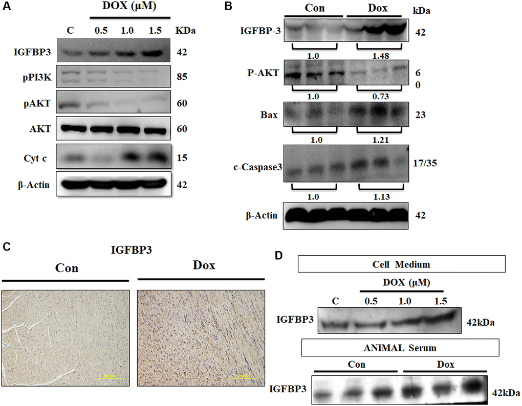 Doxorubicin increases expression and secretion of IGFBP3, and decreases cardiac cell survival in vitro and in vivo. (A) H9c2 cells were incubated with Dox for 24 h at the indicated doses and protein expression of IGFBP3 and that of the components of survival signaling pathway were measured using immunoblotting. (B) Left ventricles of control and Dox-administered rats were isolated and the levels of IGFBP3 and survival-related proteins were analyzed using western blotting. (C) IGFBP3 expression from the rat left ventricle tissue was detected using immunohistochemistry. (D) H9c2 cells were challenged with Dox for 24 h at indicated doses and the amount of secreted IGFBP3 in both cell medium and in the animal serum of Dox-treated rats was examined using western blotting. The quantitative plot of IGFBP3 from the sera of doxorubicin challenged rats is included. Scale bar indicates 200 μm.