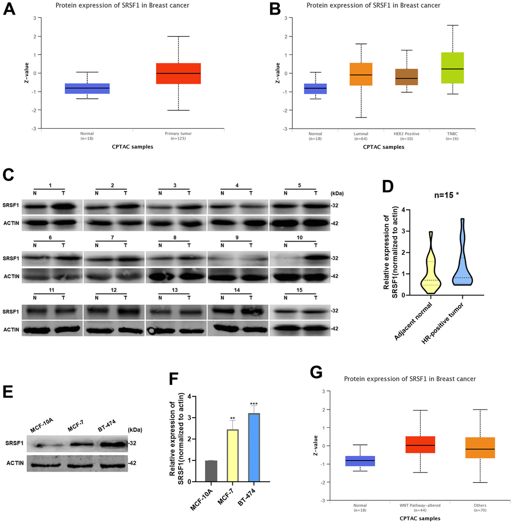 SRSF1 expression was increased in HR-positive BC. (A, B) Expression of SRSF1 in BC tissues according to the data from UALCAN database. (C, D) Relative expression of SRSF1 in HR-positive BC tissues. (E, F) Relative expression of SRSF1 in HR-positive BC cell lines. (G) Expression of SRSF1 in WNT-Pathway altered BC tissues according to the data from UALCAN database. *p