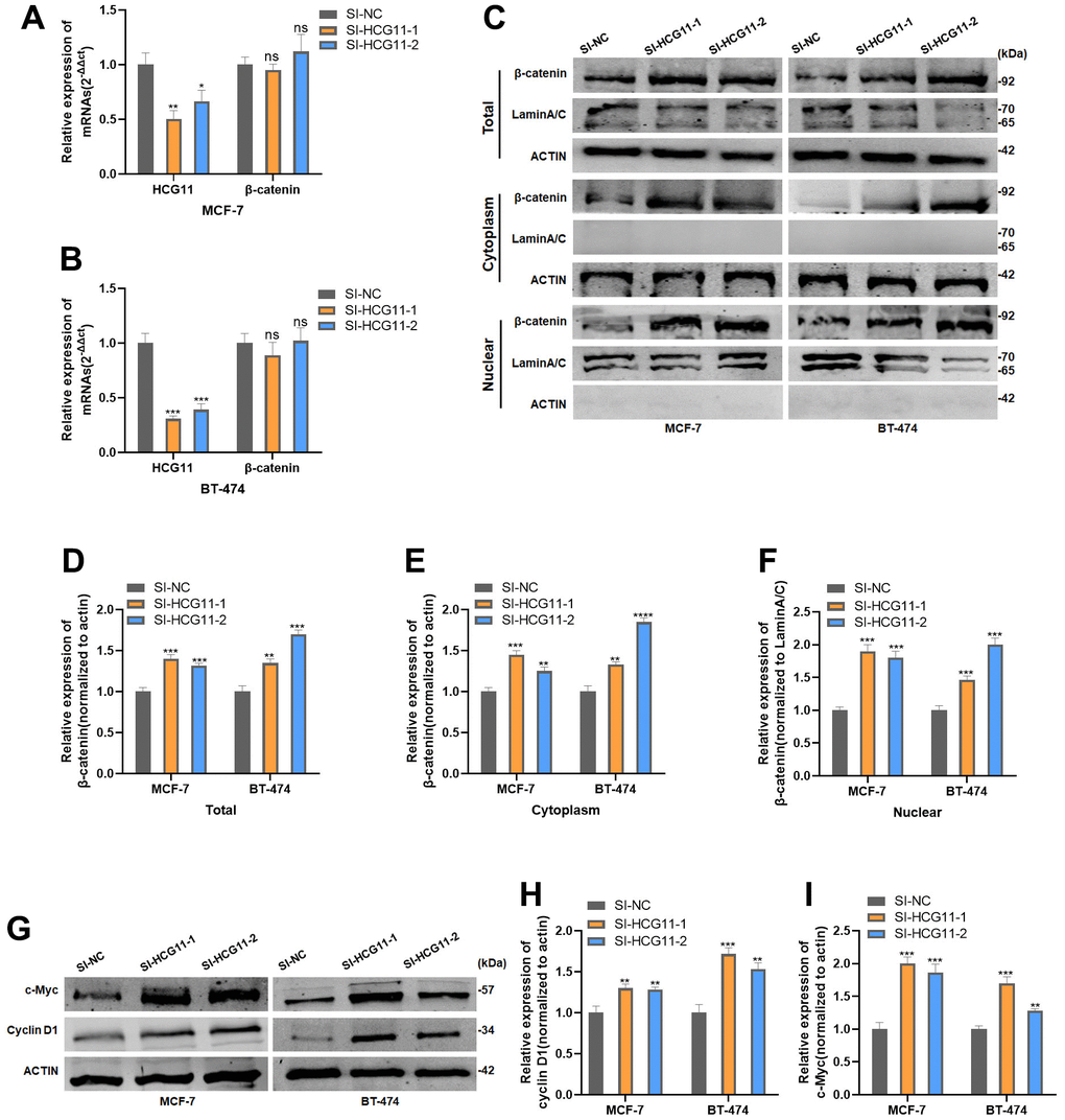 HCG11 suppressed β-catenin expression by binding to SRSF1. (A, B) mRNA level of β-catenin in MCF-7 and BT-474 cell line transfected with SI-HCG11. (C–F) Protein level of β-catenin in MCF-7 and BT-474 cell line transfected with SI-HCG11. (G–I) Protein level of c-Myc and cyclin D1 in MCF-7 and BT-474 cell line transfected with SI-HCG11. *p0.05.