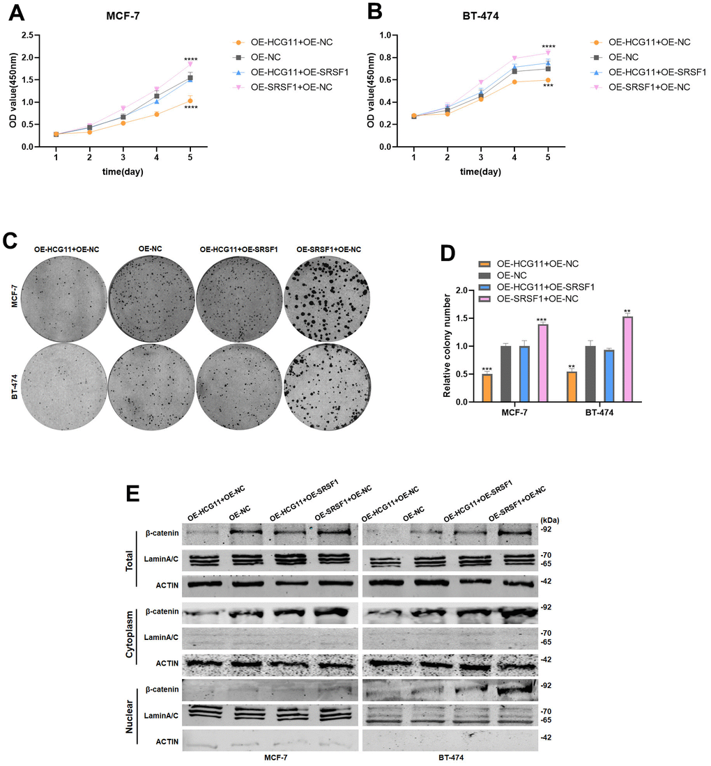 Overexpression of SRSF1 eliminated the antitumor effect of HCG11 on HR-positive BC cells. (A, B) SRSF1 rescued the suppressive effects of HCG11 on MCF-7 and BT-474 cell proliferation by CCK8 assay. (C, D) SRSF1 rescued the suppressive effects of HCG11 on MCF-7 and BT-474 cell line proliferation by colony formation assay. (E) SRSF1 rescued the low expression of β-catenin protein level caused by HCG11 by Western blot. **p