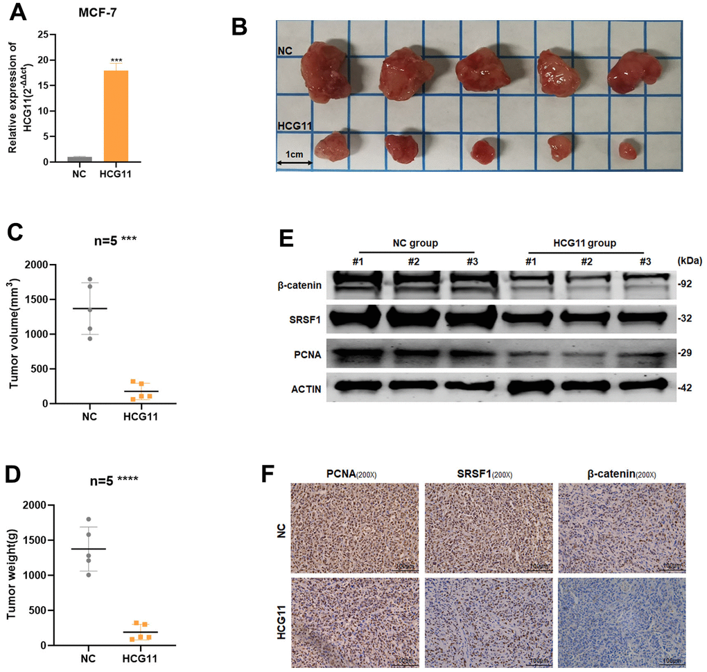 HCG11 inhibited the proliferation of HR-positive BC cells in vivo. (A) The transfection efficiency in MCF-7 cells were examined by qRT-PCR. (B) Representative images of xenograft tumors in nude mice. (C) Average tumor size of nude mice. (D) Average tumor weight of nude mice. (E) Extract protein from tumors and measuring the expression of PCNA, SRSF1 and β-catenin by Western blot. (F) Immunohistochemistry (IHC) staining of PCNA, SRSF1 and β-catenin in xenografts tumors. ***p