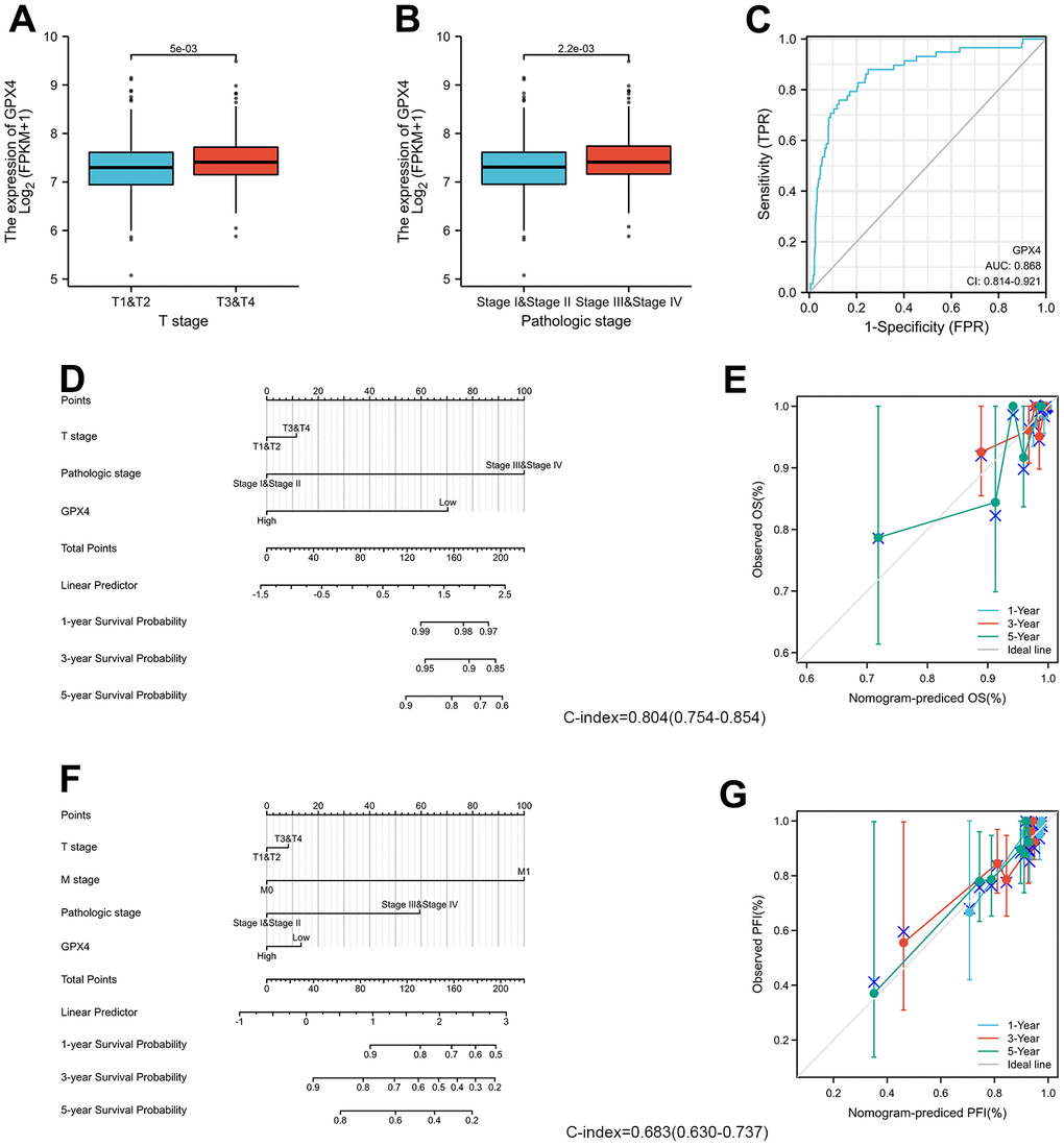 GPX4 expression and clinicopathological features in thyroid cancer patients. The Wilcoxon rank sum test was applied to analyze associations of clinical T stage (A) and pathologic stage (B) with GPX4 expression. (C) ROC curve analysis evaluating the diagnostic performance of GPX4 in thyroid cancer. (D) Nomogram was built to examine 1-, 3-, and 5-year overall survival based on the risk score model of GPX4 expression. (E) Calibration plot verifying the efficiency of the nomogram for overall survival. (F) Nomogram was built to examine 1-, 3-, and 5-year progression-free interval based on the risk score model of GPX4 expression. (G) Calibration plots verifying the efficiency of the nomogram for progression-free interval.