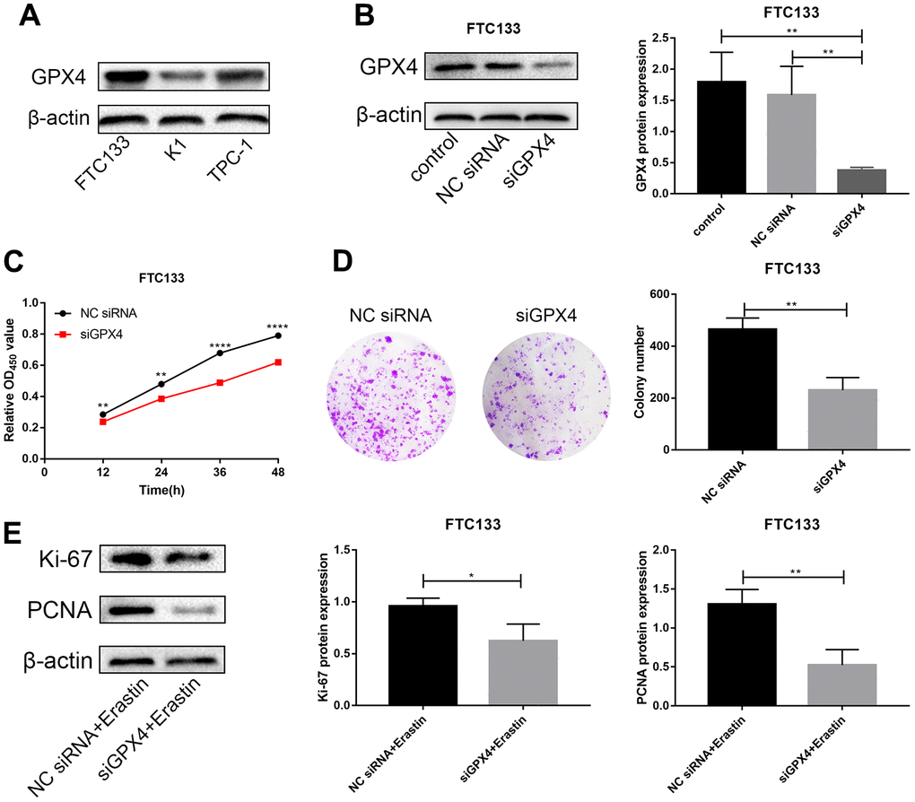 Knockdown of GPX4 inhibits proliferation in thyroid cancer cells. (A) GPX4 expression levels in FTC133, K1 and TPC-1 cells by western blot analysis. (B) GPX4 expression in FTC133 cells transfected with control, NC siRNA, or siGPX4 was confirmed by western blot analysis. (C) A CCK-8 assay was used to evaluate the viability of FTC133 cells transfected with NC siRNA/siGPX4. (D) Colony formation assay demonstrated the proliferation ability of FTC133 cells transfected with NC siRNA/siGPX4. (E) Ki-67 and PCNA protein expression in FTC133 cells transfected with NC siRNA/siGPX4 under erastin treatment.
