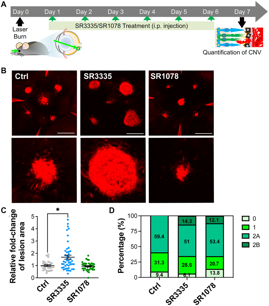 Pharmacological modulation of RORα affects CNV lesion size in mice. (A) A cartoon of the drug treatment timeline in laser-induced CNV. RORα inverse agonist (SR3335), agonist (SR1078), or vehicle control was intraperitoneally injected (daily) into C57BL/6J mice after laser-induced CNV. (B) Representative images of isolectin-stained (red) choroidal flat mounts, isolated from mice of all treatment groups on day 7 after laser photocoagulation. Scale bars, 500 μm. (C) Quantification of isolectin-stained CNV area showed significantly increased CNV lesion size in the mice treated with SR3335, and while as the CNV lesion size in the SR1078-treated group did not show significant change, compared to the vehicle control treated group (n = 5–8 mice/group). (D) Vascular leakage from CNV lesions were assessed by fundus fluorescein angiography (FFA) at day 6 after laser photocoagulation and graded on an ordinal scale of the fluorescein leakage appearance: grade 0 (no leakage); grade 1 (questionable leakage); grade 2A (leaky); grade 2B (pathologically significant leakage). n = 5–8 mice/group. Data are presented as mean ± SEM. *P ≤ 0.05.