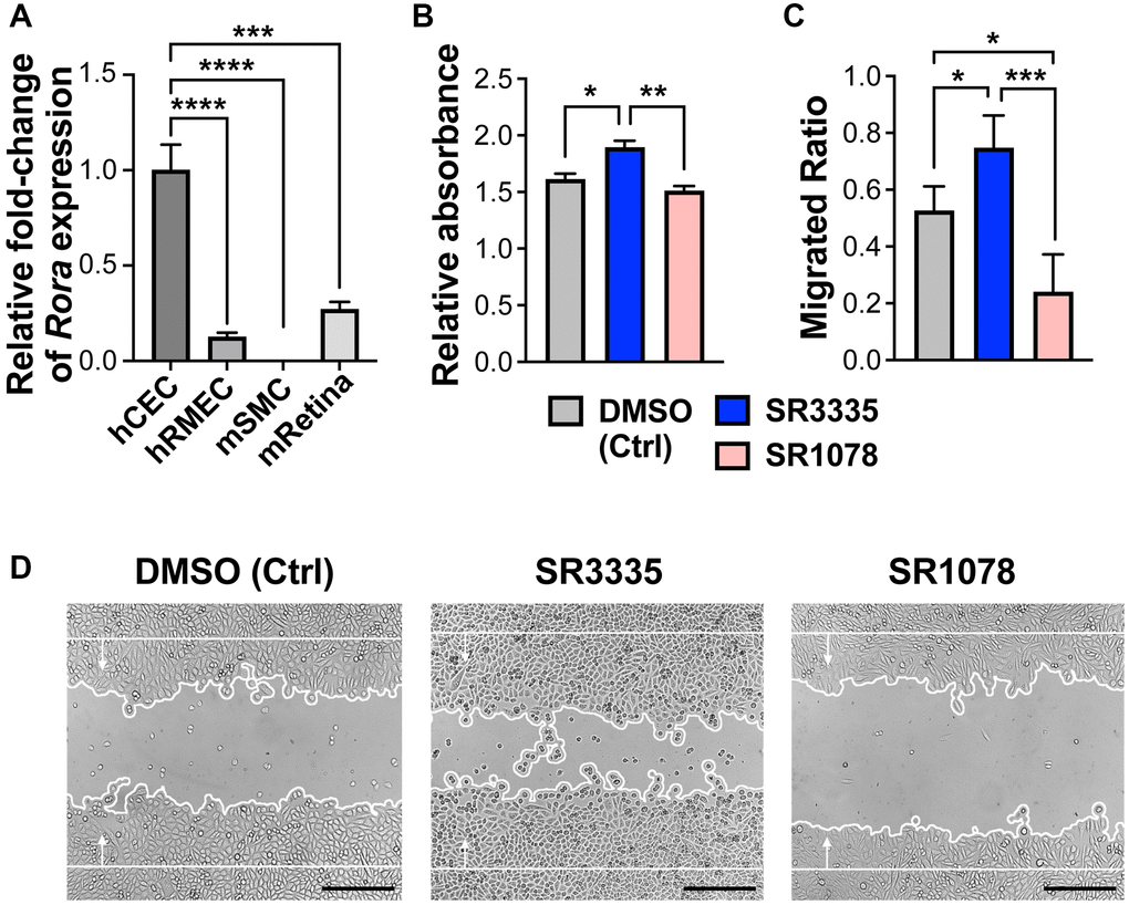 Pharmacological modulation of RORα regulates human choroidal endothelial cell angiogenic function. (A) Relative mRNA expression of RORα in human choroidal endothelial cell (hCEC), human retinal microvascular endothelial cell (hRMEC), mouse brain smooth muscle cell (mSMC) and mouse whole retina (mRetina), measured with quantitative RT-PCR and normalized to housekeeping gene GAPDH (human) and Gapdh (mouse) respectively. n = 3/group. (B) HCECs were treated with RORα inverse agonist (SR3335), agonist (SR1078), or DMSO vehicle control. MTT assay was performed to evaluate cell viability and proliferation. Cell growth was calculated as fold change of relative absorbance normalized to the values at 0 hr. n = 3/group. (C, D) Quantification analysis (C) and representative images (D) of hCEC migration assay. Cells were grown to confluence and treated with SR3335, SR1078, or DMSO vehicle control. Mitomycin was used to inhibit cell proliferation. A scratch wound was generated in the cells. Cell migration were measured after 24 hr and quantified as new cell coverage areas normalized by the original wound areas. n = 4/group. Scale bar: 250 μm. *P ≤ 0.05; **P ≤ 0.01; ***P ≤ 0.001; ****P ≤ 0.0001.