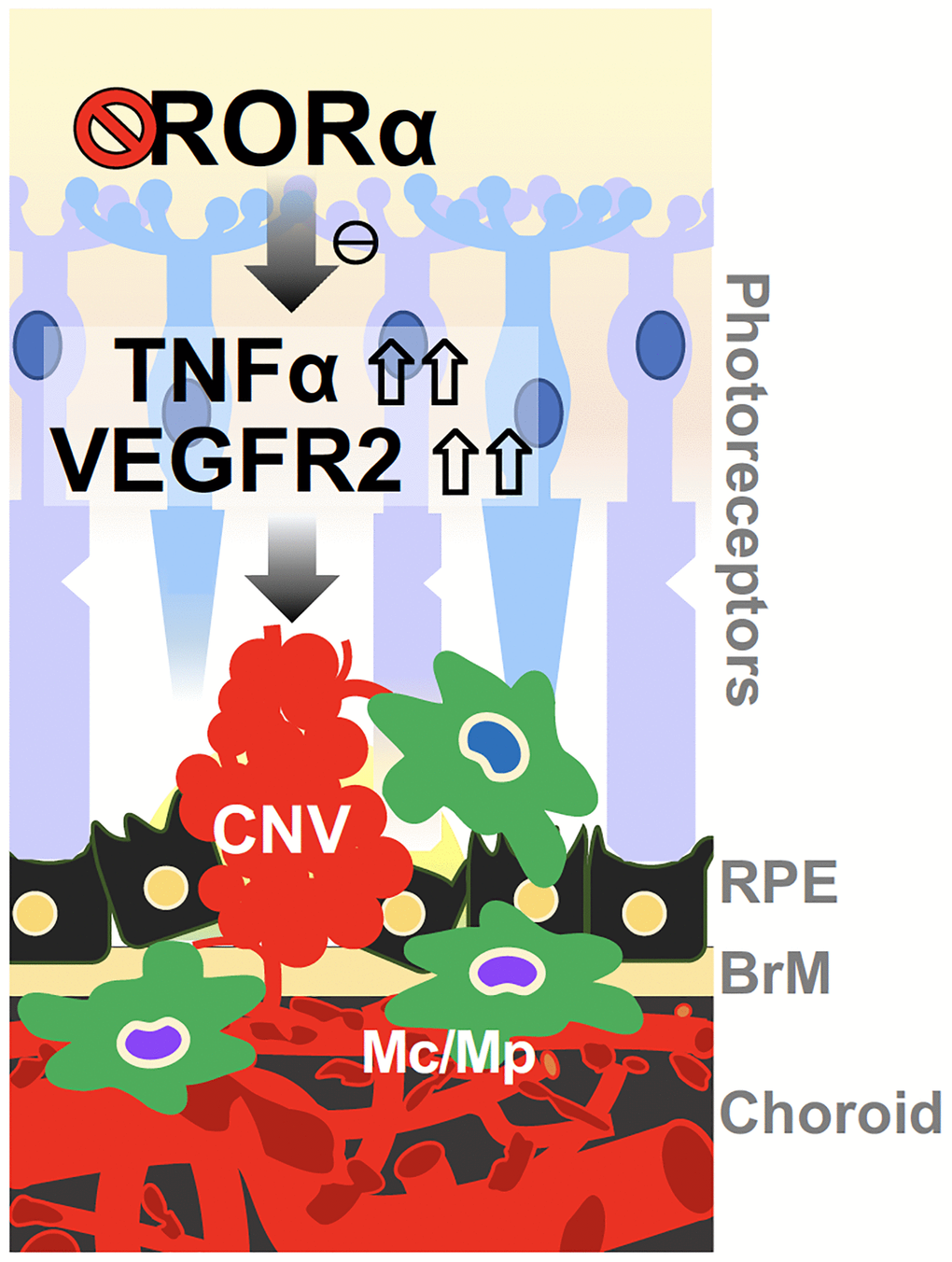 A schematic model for the effects of RORα on regulating CNV in wet AMD. Deficiency of RORα in choroid vessels directly induces expression of VEGF receptor VEGFR2, leading to enhanced choroidal endothelial angiogenic response and exacerbated pathological CNV formation. RORα deficiency may also influence CNV via increased TNFα, and chronic inflammation in the choroidal local environment, to potentially sensitize VEGF angiogenic response and thereby CNV formation. Abbreviations: BrM: Bruch’s membrane; CNV: choroidal neovascularization; Mc: microglial cell; Mp: macrophage; RPE: retinal pigment epithelium.