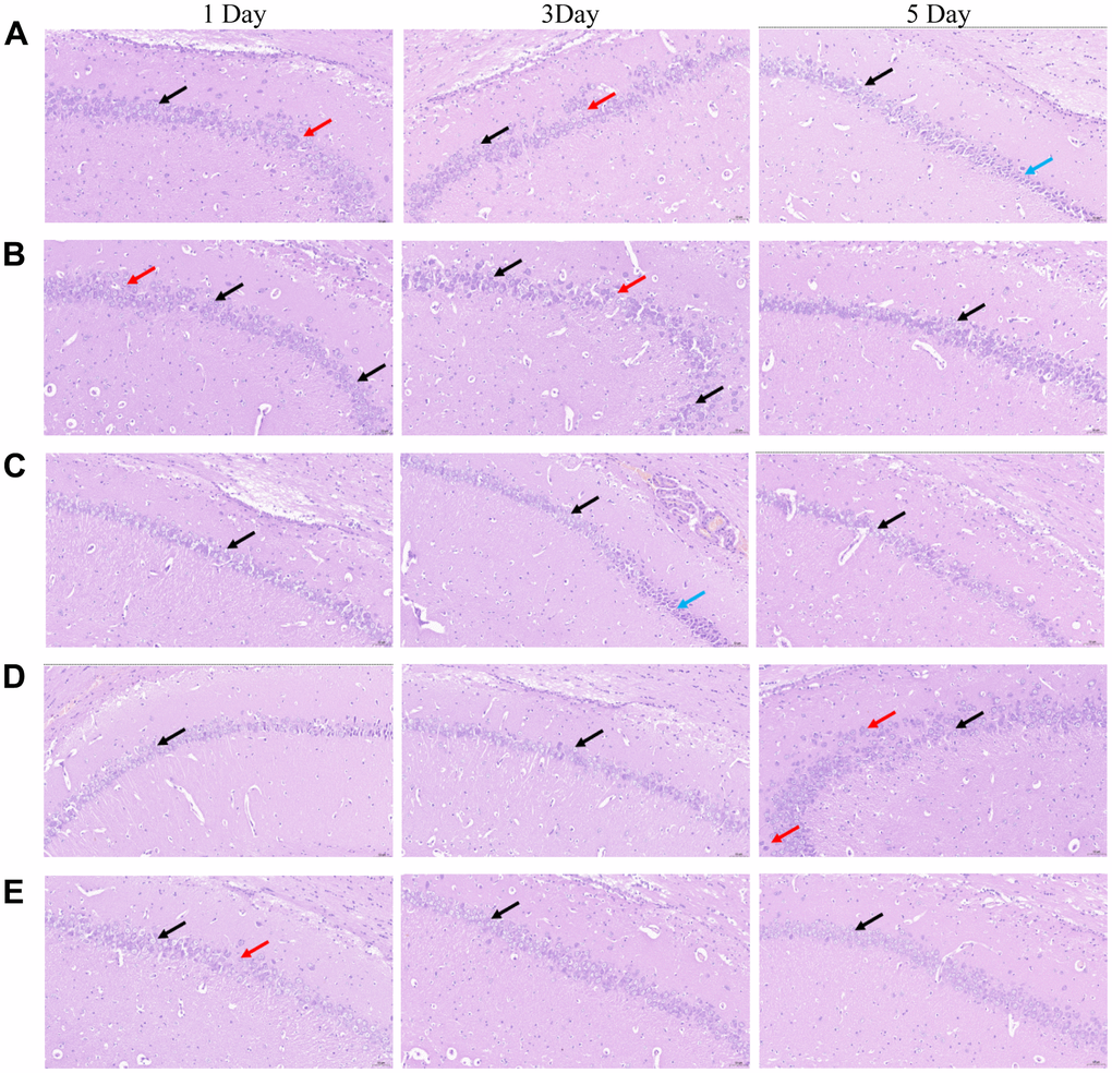 Morphological changes in the CA 1 region of the hippocampi of rats in the five groups were observed by conducting HE staining. (A) blank group, (B) solvent group, (C) NBP group, (D) NBP + agonist group, and (E) NBP + inhibitor group. (Scale bar = 20 μm, magnification = 400 ×).