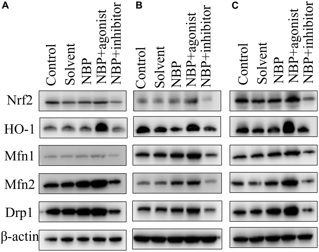 NBP’s effects on the expressions of Nrf2, Mfn1, Mfn2, and Drp1 in hippocampal tissues by Western blots. (A) one day after the operation. (B) three days after the operation. (C) five days after the operation.