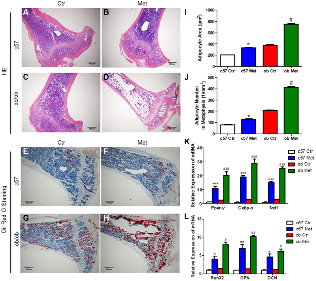 Metformin increased MAT in C57BL/6 and ob/ob mice. Adipocyte size was assessed in high-power field images of the proximal tibia. Representative images of HE staining (A–D) and oil red O staining (E–H) for each group. (I) Area of adipocytes represented as mean ± SEM. (J) The number of adipocytes per square millimeter. mRNA relative expression of adipogenic genes (Ppar-γ, Cebp-α, Scd1) (K) and osteogenic genes (RunX2, OPN, OCN) (L) in the bone marrow. Data are presented as mean ± S.E.M. *P **P ***P #P ##P ###P 