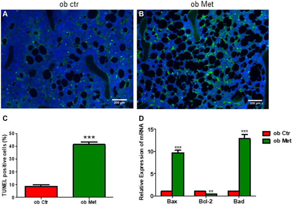 Metformin increased bone marrow cell apoptosis in ob/ob mice. (A, B) TUNEL staining in control and metformin-treated mice tibia sections (scale bar = 200 mm). (C) Quantification of TUNEL-positive cells in the proximal tibia. (D) mRNA relative expression of apoptosis-related genes (Bax, Bcl-2, Bad) in the bone marrow. Data are presented as mean ± S.E.M. **P ***P 