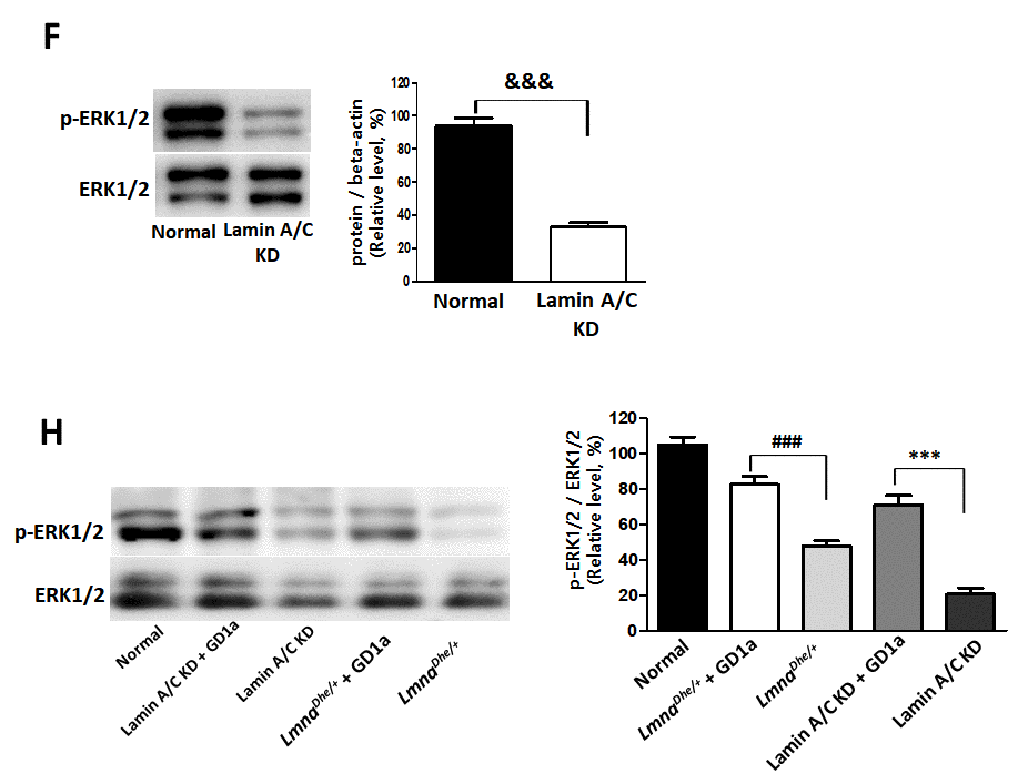 Increases of osteogenesis and ERK1/2 activation in GD1a-treated Lmna dysfunction MSCs.… dysfunction MSCs. (F) Lamin A/C was knocked down in mouse MSCs using siRNA. (G) Primary MSCs with LmnaDhe/+ mutation were isolated from LmnaDhe/+ mice. (H) Phosphorylation of ERK1/2 in Lmna dysfunction MSCs treated with GD1a. (I)…. Phosphorylation of ERK1/2 was determined by western blotting with anti-p-ERK1/2. ERK1/2 was used as a loading control. Values represent mean ± SD; &&&p p LmnaDhe/+ mutant MSCs; ###p $$$p 