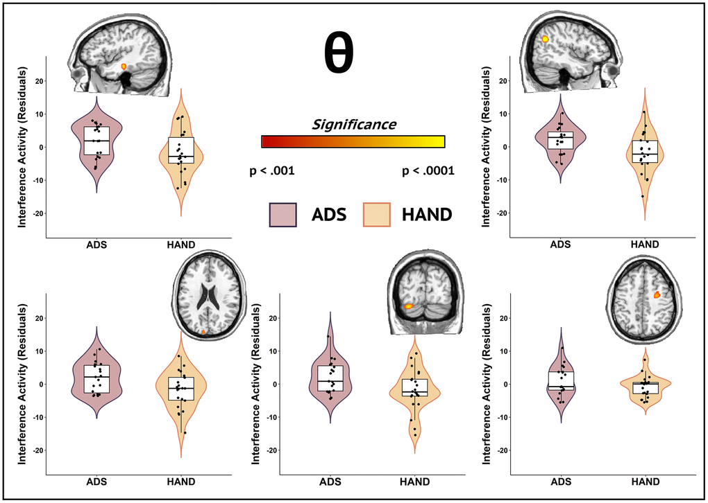 Participants in the ADS group exhibited stronger theta interference activity compared to those in the HAND group during attentional processing. Whole-brain group comparison maps of theta interference activity are shown. Images for each significant cluster of activity are accompanied by the violin plots of the amplitude values for the peak voxel. Group differences (p 