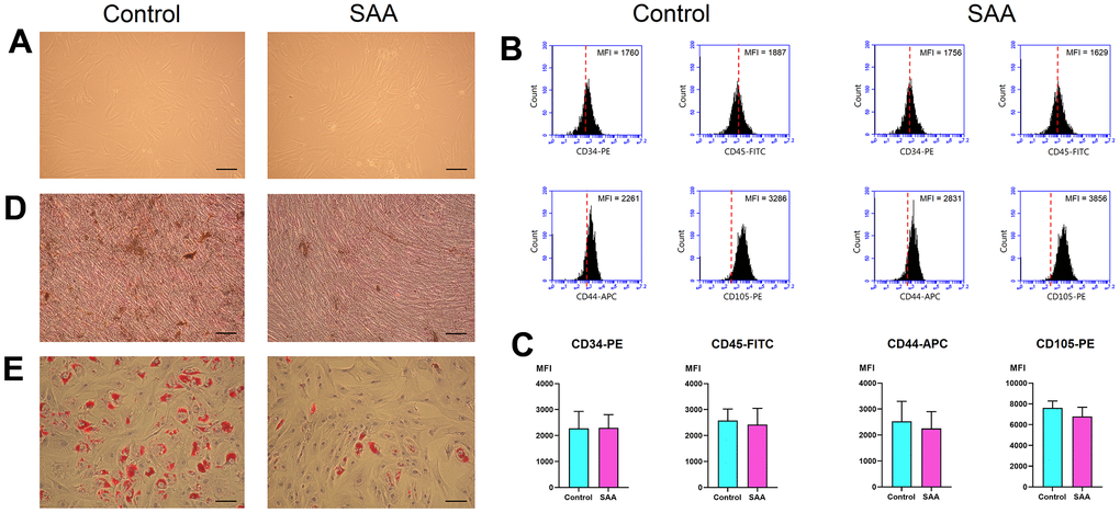 Characterization of MSCs. (A) In vitro culture, MSCs in the control and SAA groups shared similar growth patterns and morphologies (×100; scale bar = 100 μm). (B) Using flow cytometry, these cells were negative for CD34 and CD45, and positive for CD44 and CD105. The red dashed line indicates the isotype control; the black area indicates the stained cells. (C) There was no significant difference in the expressed MFI of CD34-PE, CD45-FITC, CD44-APC, and CD105-PE between the SAA group and the control group. (D) Osteogenic differentiation was demonstrated by mineralized deposits stainable with von Kossa stain (×100; scale bar = 100 μm). (E) Adipogenic differentiation was confirmed by intracellular accumulation of lipid droplets stainable with oil red O (×100; scale bar = 100 μm). MFI: Mean fluorescence intensity; ns: not significant; SAA: Severe aplastic anemia.