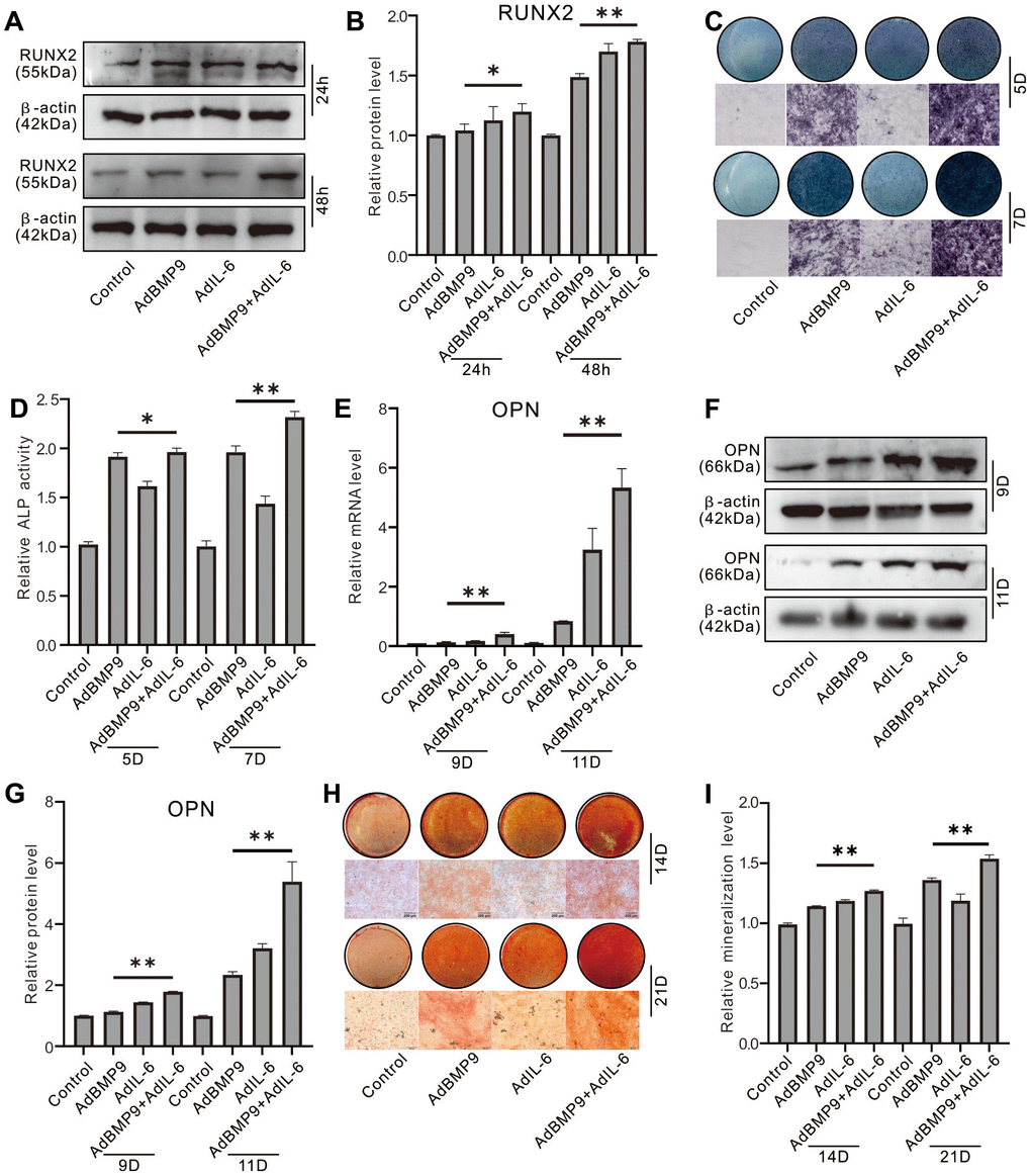 Effect of IL-6 on the osteoblastic markers induced by BMP9 in MEFs. (A) Effect of BMP9 and/or IL-6 on RUNX2 protein level were measured with western blot assay. (B) Western blot assay quantification shows the effect of BMP9 and/or IL-6 on RUNX2 protein level. (C) Effect of BMP9 and/or IL-6 on ALP activity was measure using histochemical stain. (D) Quantification of histochemical stain shows the effect of BMP9 and/or IL-6 on ALP activity. (E) Effect of BMP9 and/or IL-6 on OPN mRNA expression was measured using real-time PCR assay. (F) Western blot assay shows the effect of BMP9 and/or IL-6 on OPN protein level. (G) Quantification results of western blot assay show the effect of BMP9 and/or IL-6 on OPN protein level. (H) Effect of BMP9 and/or IL-6 on mineralization was measured using Alizarin Red S stain. (I) Quantification of Alizarin Red S stain show the effect of BMP9 and/or IL-6 on mineralization. (*P **P 